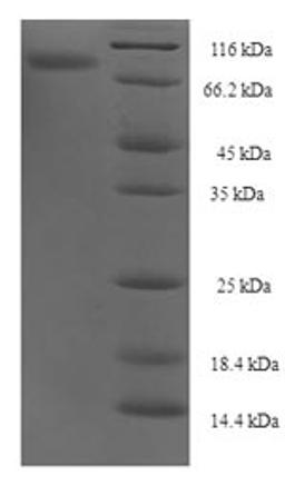 (Tris-Glycine gel) Discontinuous SDS-PAGE (reduced) with 5% enrichment gel and 15% separation gel.