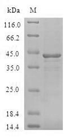 (Tris-Glycine gel) Discontinuous SDS-PAGE (reduced) with 5% enrichment gel and 15% separation gel.
