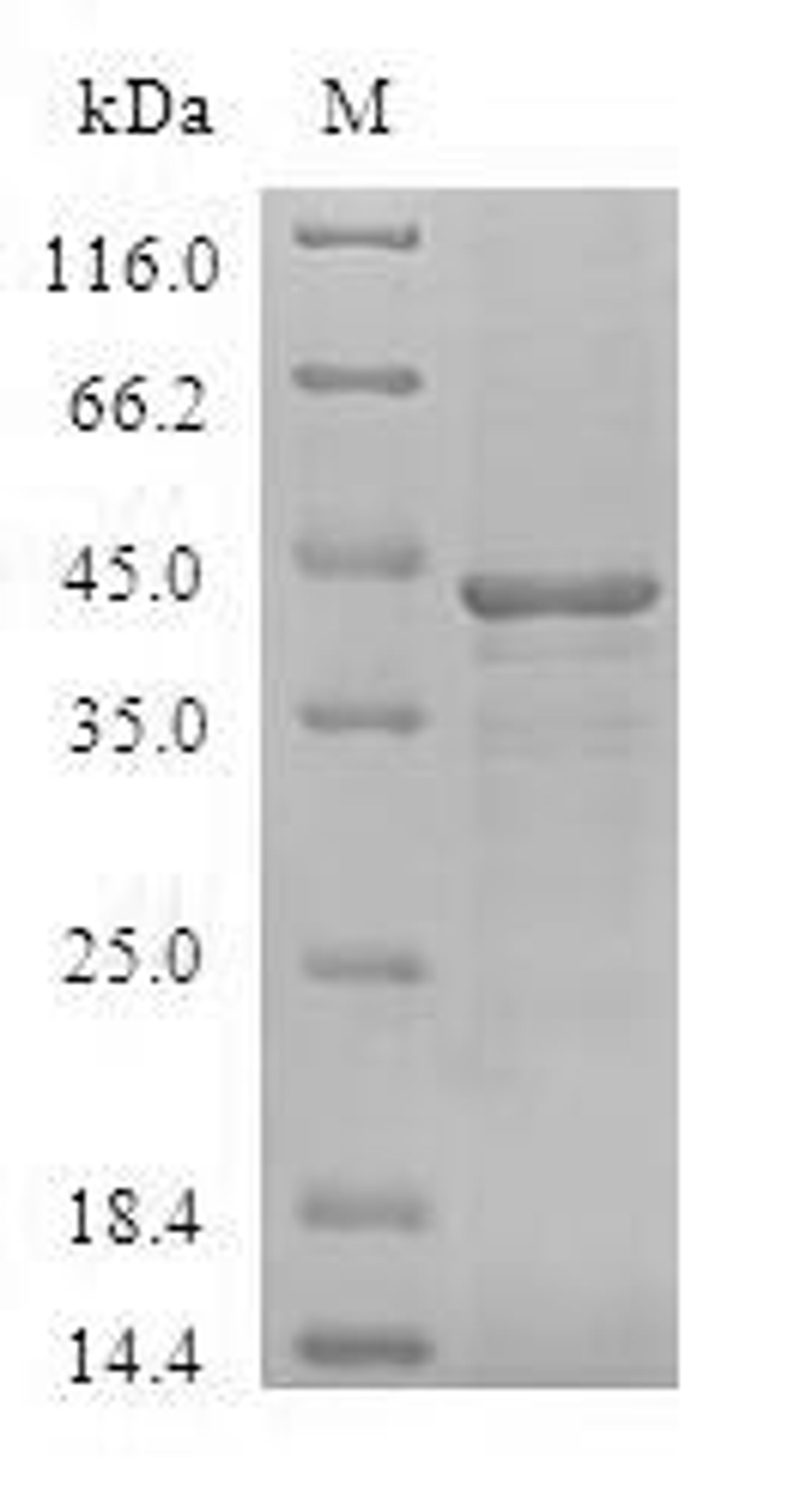 (Tris-Glycine gel) Discontinuous SDS-PAGE (reduced) with 5% enrichment gel and 15% separation gel.