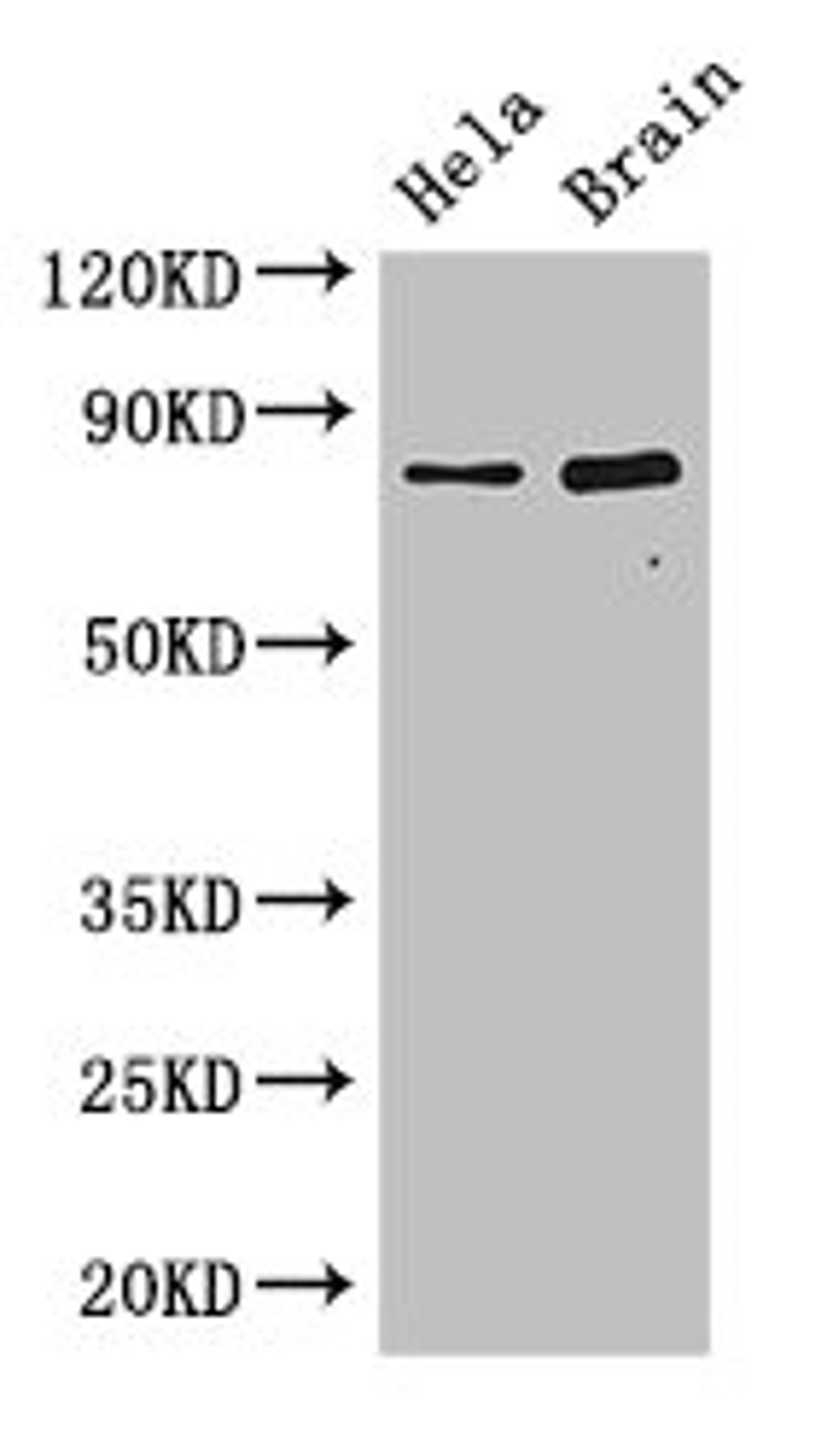 Western Blot. Positive WB detected in: Hela whole cell lysate, Mouse brain tissue. All lanes: DACH1 antibody at 2.8ug/ml. Secondary. Goat polyclonal to rabbit IgG at 1/50000 dilution. Predicted band size: 47, 12 kDa. Observed band size: 79 kDa. 