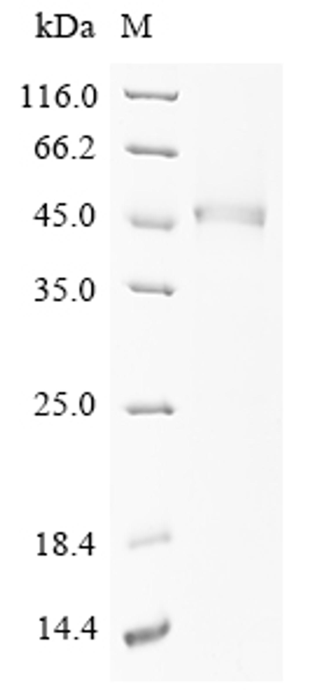 (Tris-Glycine gel) Discontinuous SDS-PAGE (reduced) with 5% enrichment gel and 15% separation gel.