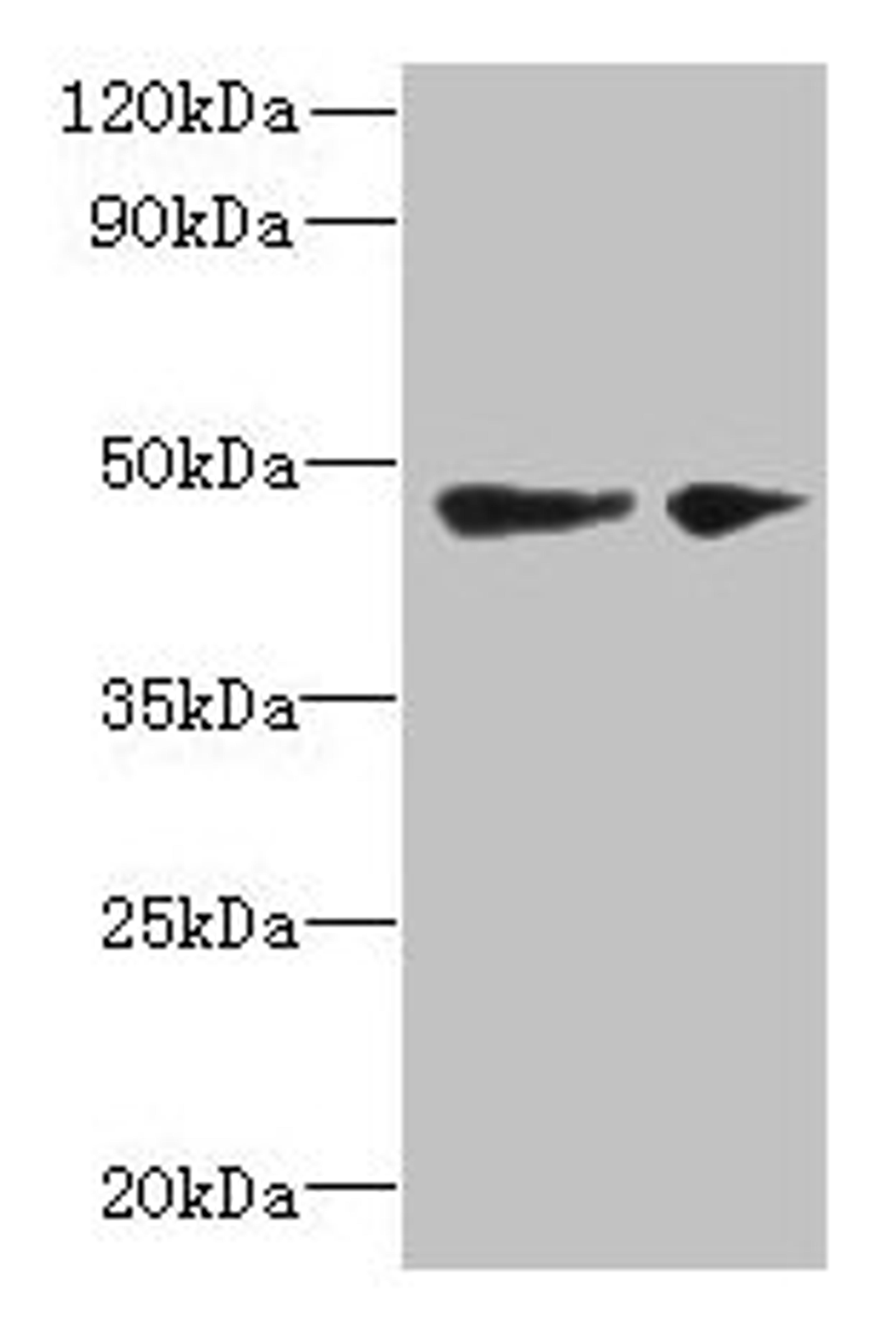 Western blot. All lanes: SLC25A46 antibody at 6µg/ml. Lane 1: Mouse brain tissue. Lane 2: Jurkat whole cell lysate. Secondary. Goat polyclonal to rabbit IgG at 1/10000 dilution. Predicted band size: 47, 31, 38 kDa. Observed band size: 47 kDa