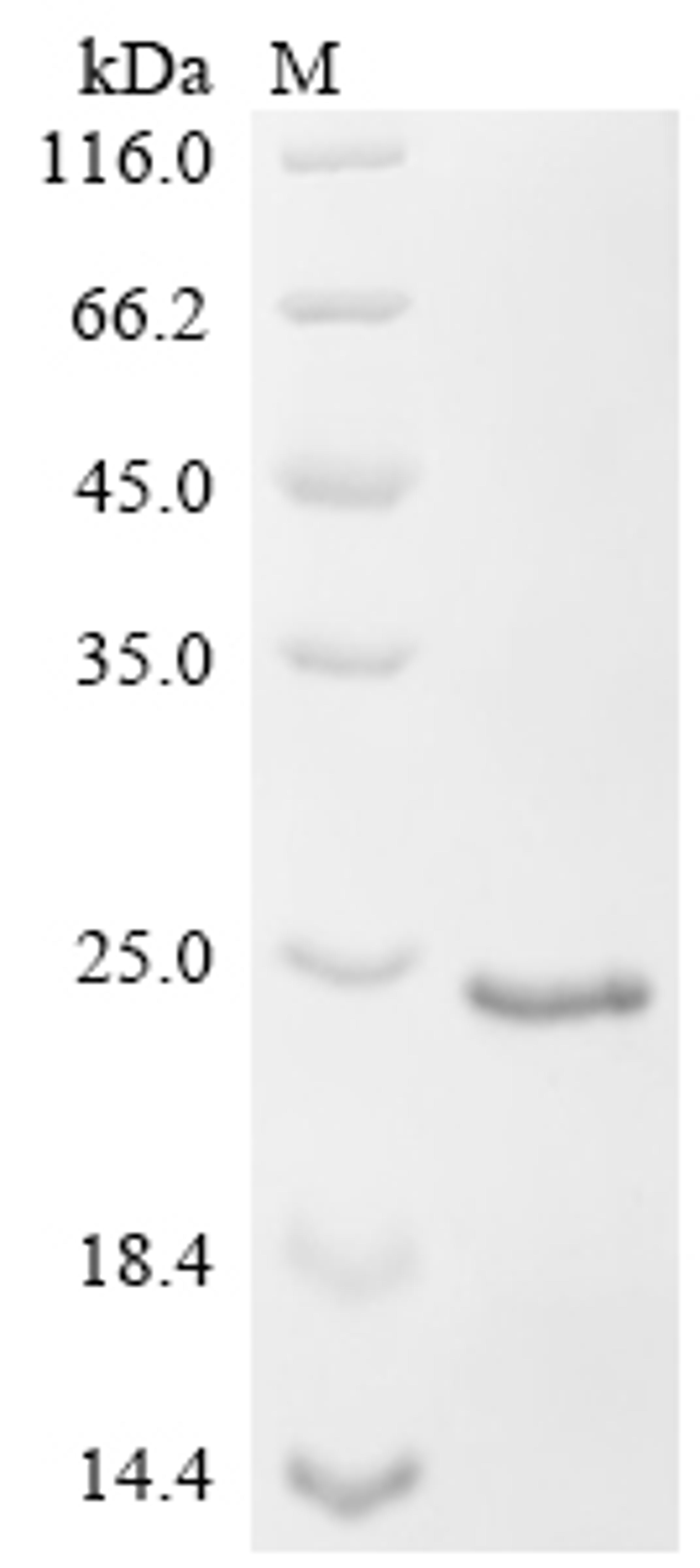(Tris-Glycine gel) Discontinuous SDS-PAGE (reduced) with 5% enrichment gel and 15% separation gel.