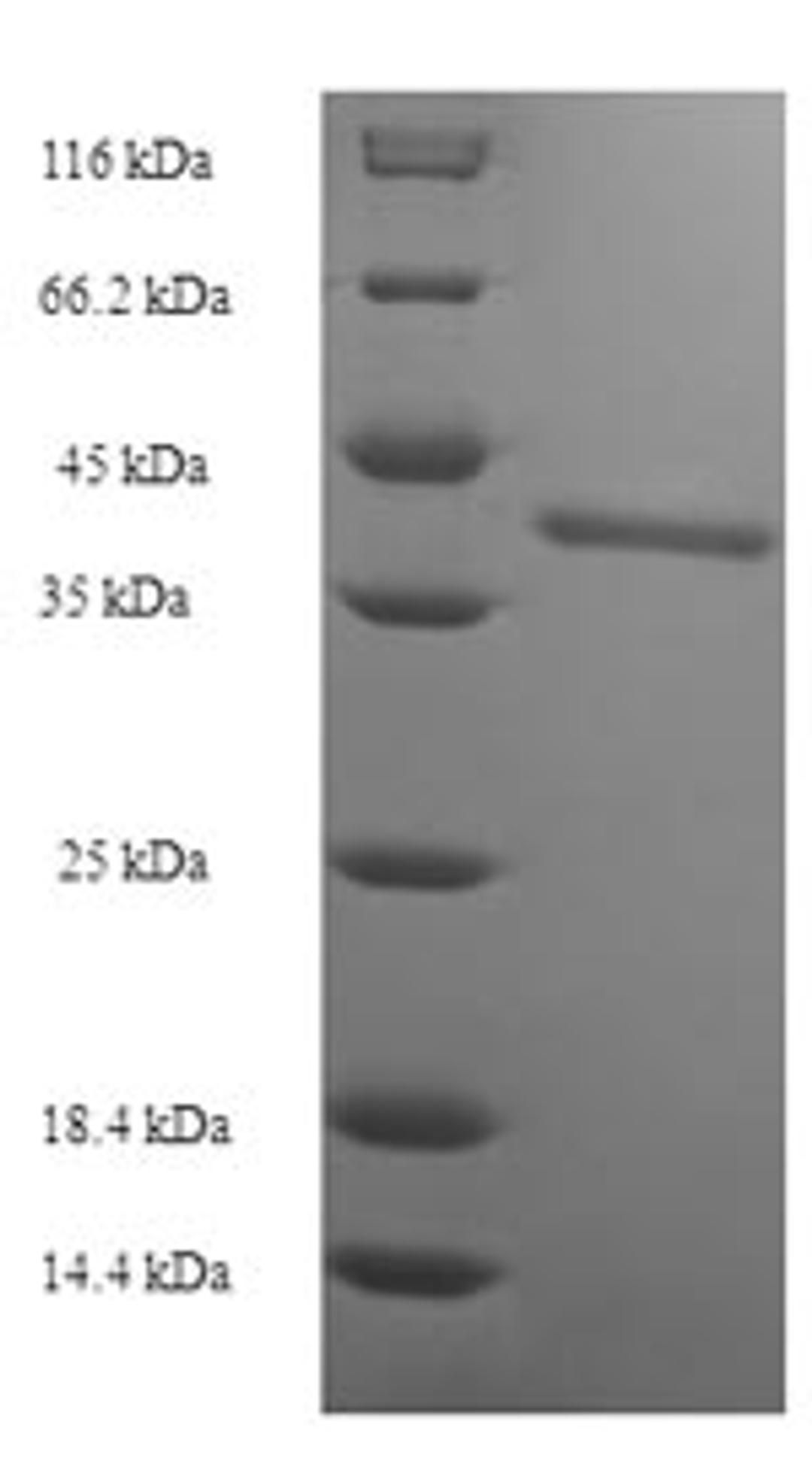 (Tris-Glycine gel) Discontinuous SDS-PAGE (reduced) with 5% enrichment gel and 15% separation gel.