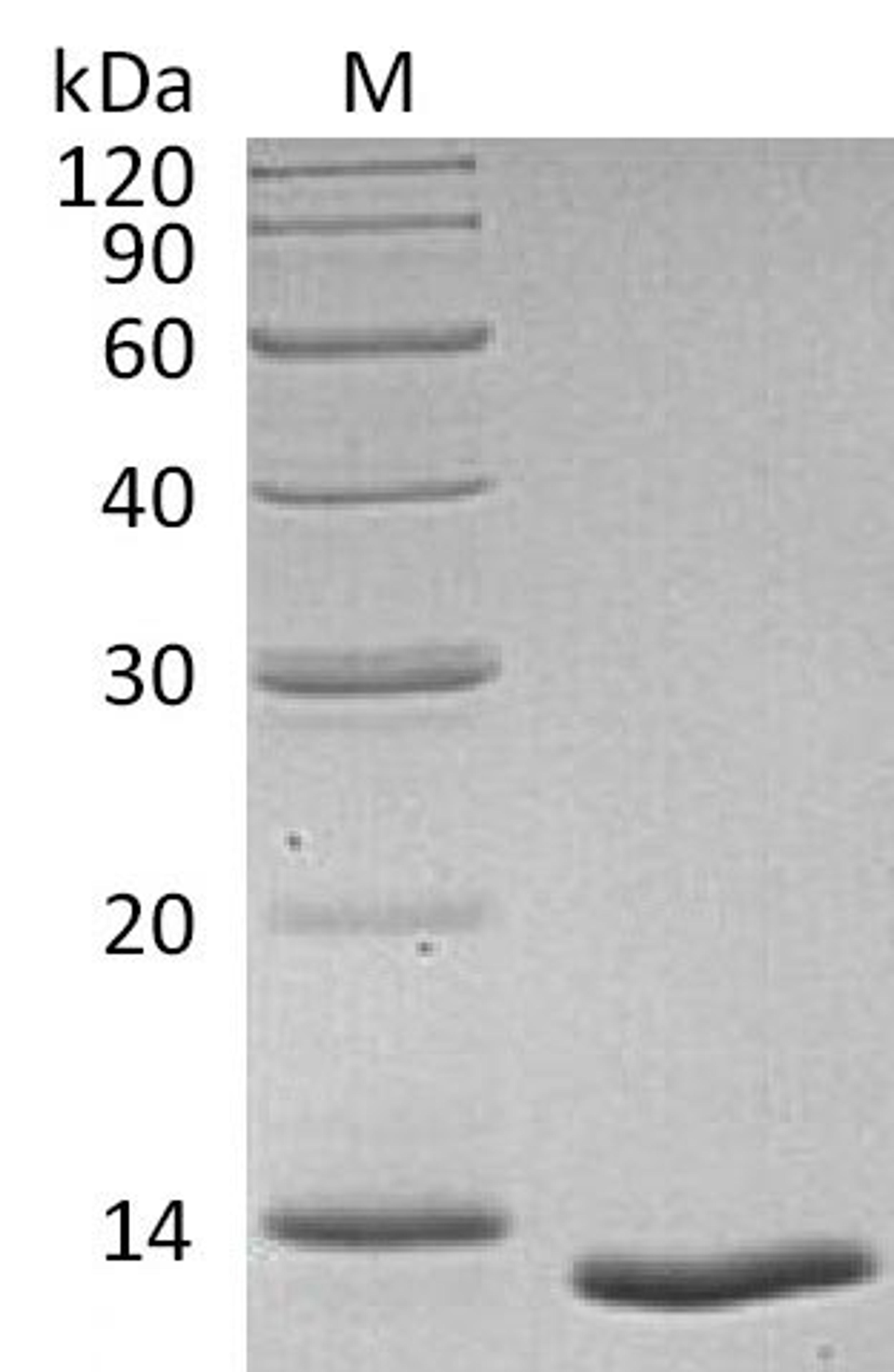 (Tris-Glycine gel) Discontinuous SDS-PAGE (reduced) with 5% enrichment gel and 15% separation gel.