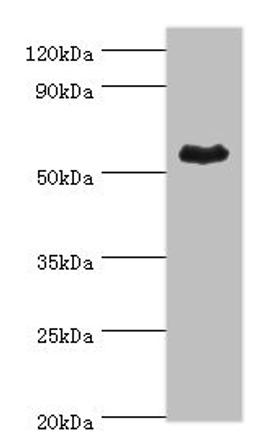 Western blot. All lanes: Retinal dehydrogenase 1 antibody at 4ug/ml + Mouse liver tissue. Secondary. Goat polyclonal to rabbit IgG at 1/10000 dilution. Predicted band size: 55 kDa. Observed band size: 55 kDa. 