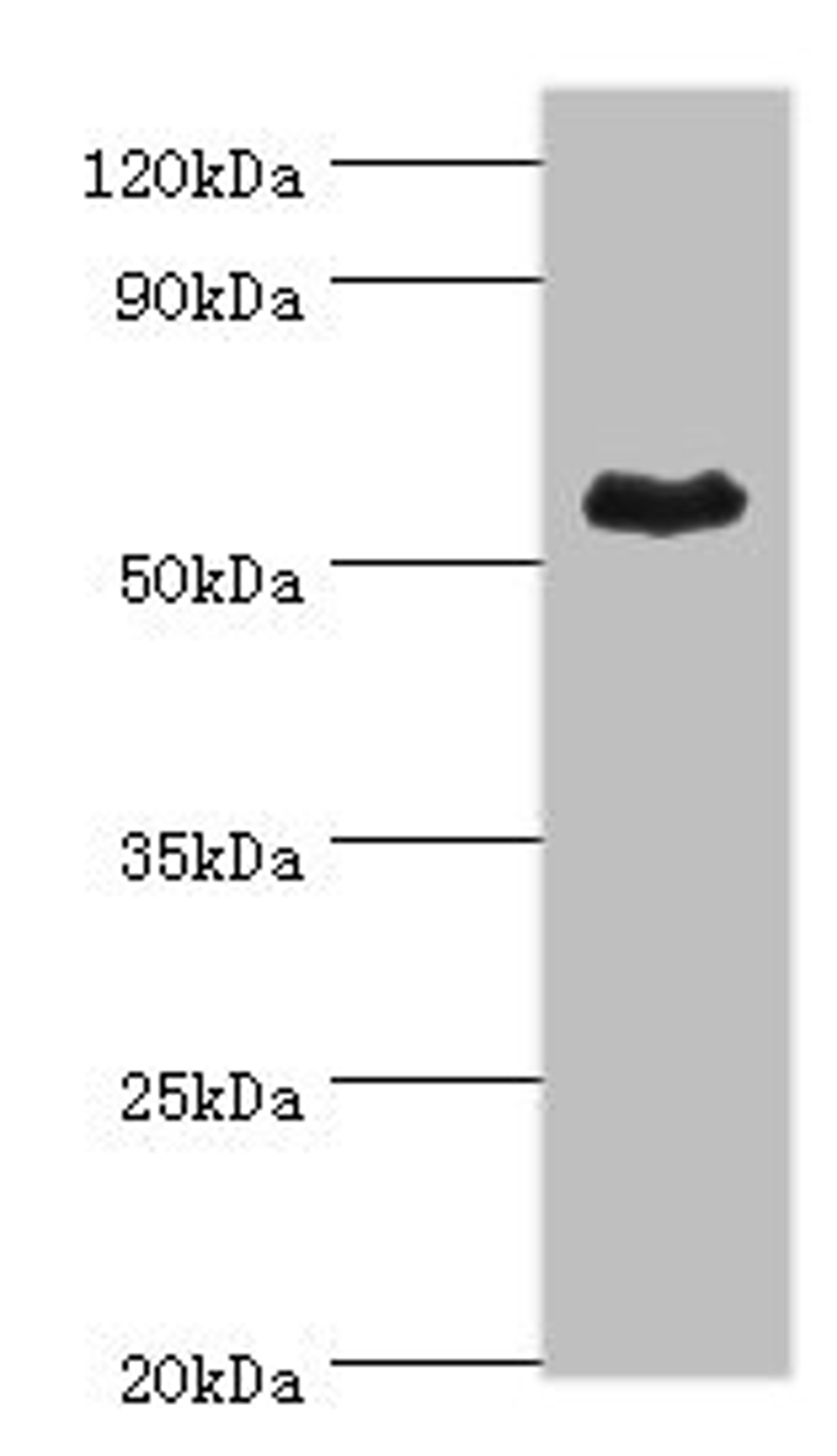 Western blot. All lanes: Retinal dehydrogenase 1 antibody at 4ug/ml + Mouse liver tissue. Secondary. Goat polyclonal to rabbit IgG at 1/10000 dilution. Predicted band size: 55 kDa. Observed band size: 55 kDa. 