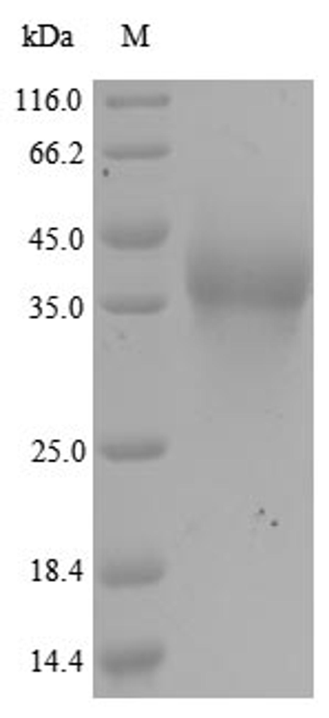 (Tris-Glycine gel) Discontinuous SDS-PAGE (reduced) with 5% enrichment gel and 15% separation gel.