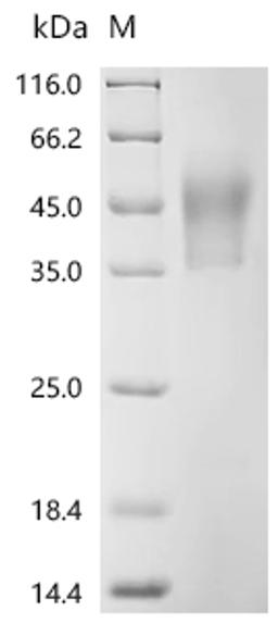 (Tris-Glycine gel) Discontinuous SDS-PAGE (reduced) with 5% enrichment gel and 15% separation gel.