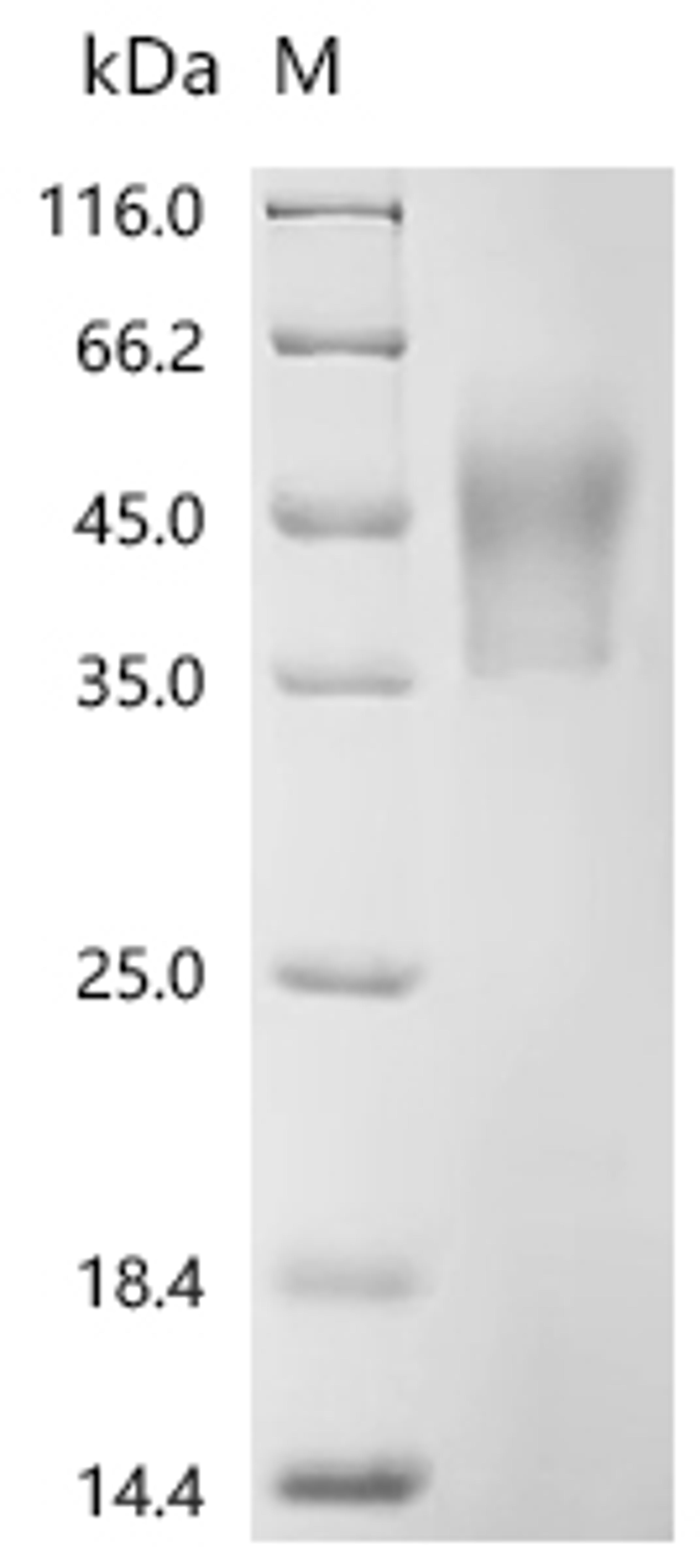 (Tris-Glycine gel) Discontinuous SDS-PAGE (reduced) with 5% enrichment gel and 15% separation gel.