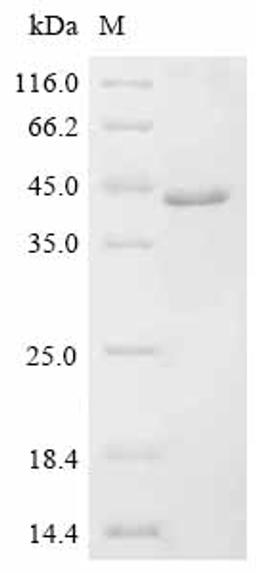 (Tris-Glycine gel) Discontinuous SDS-PAGE (reduced) with 5% enrichment gel and 15% separation gel.