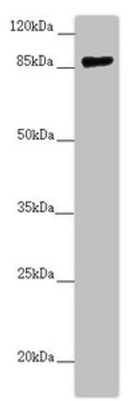Western blot. All lanes: CCHCR1 antibody at 2.67 ug/ml + 293T whole cell lysate. Secondary. Goat polyclonal to rabbit IgG at 1/10000 dilution. Predicted band size: 89, 100, 96 kDa. Observed band size: 89 kDa. 