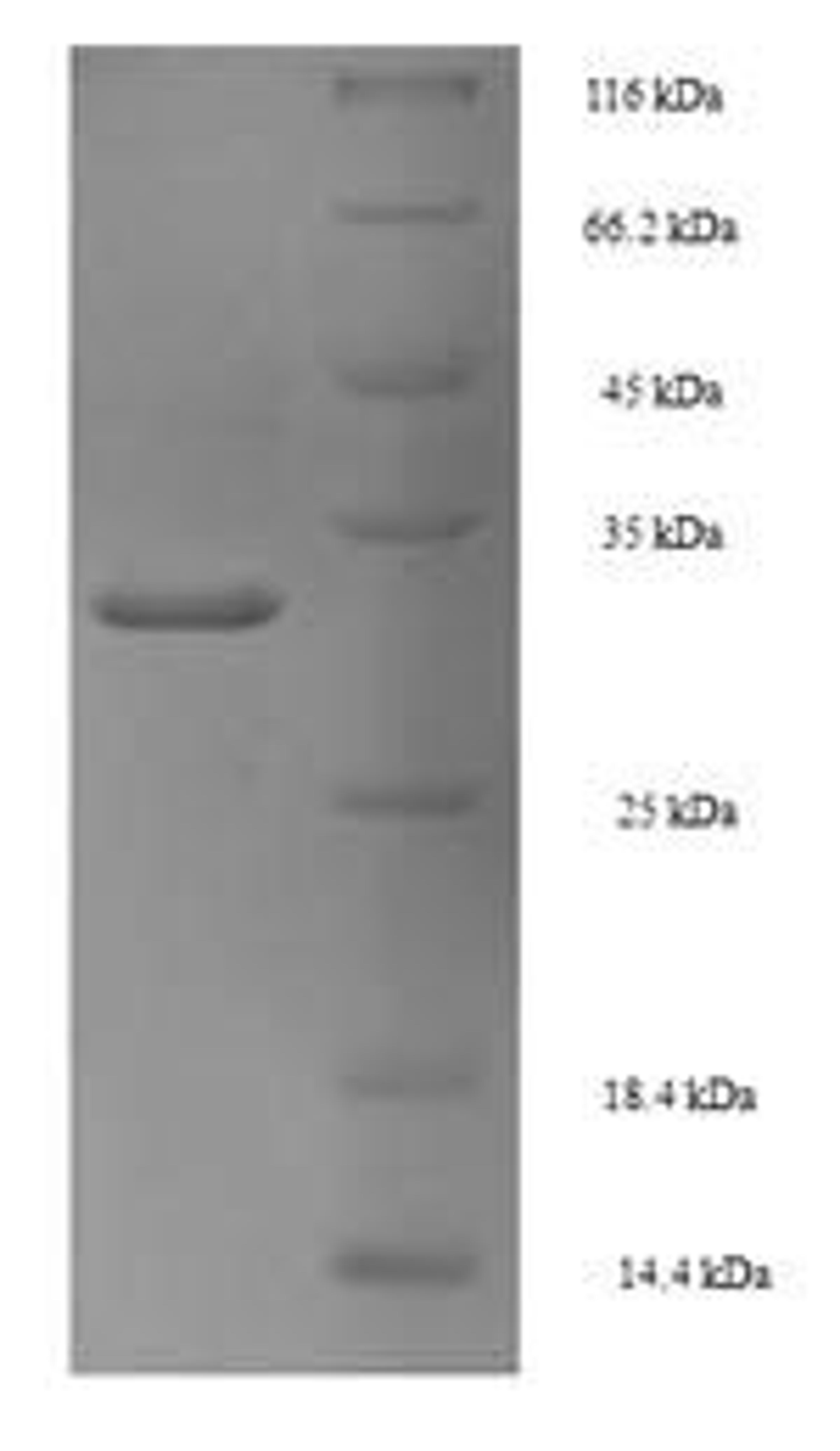 (Tris-Glycine gel) Discontinuous SDS-PAGE (reduced) with 5% enrichment gel and 15% separation gel.