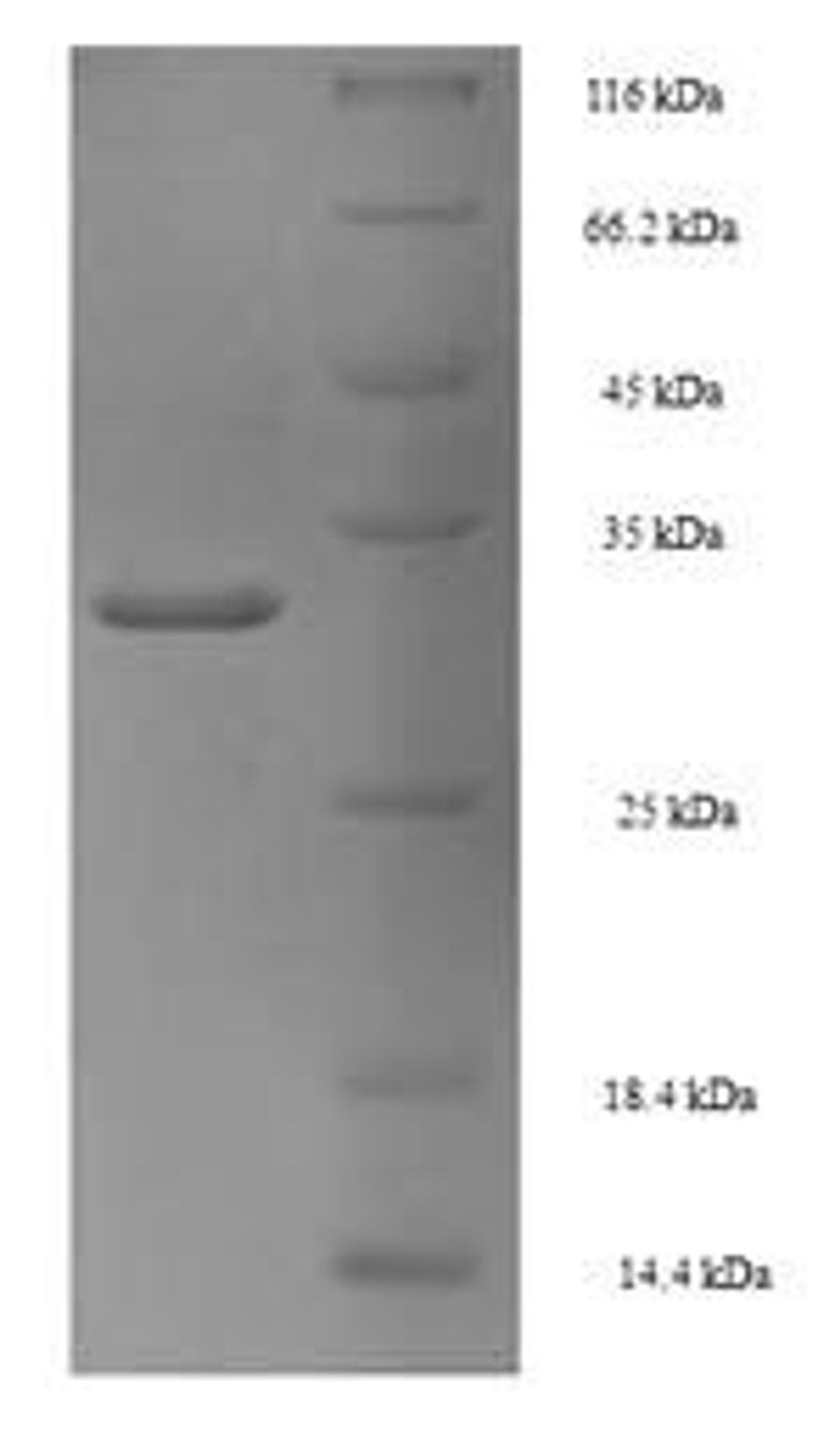 (Tris-Glycine gel) Discontinuous SDS-PAGE (reduced) with 5% enrichment gel and 15% separation gel.