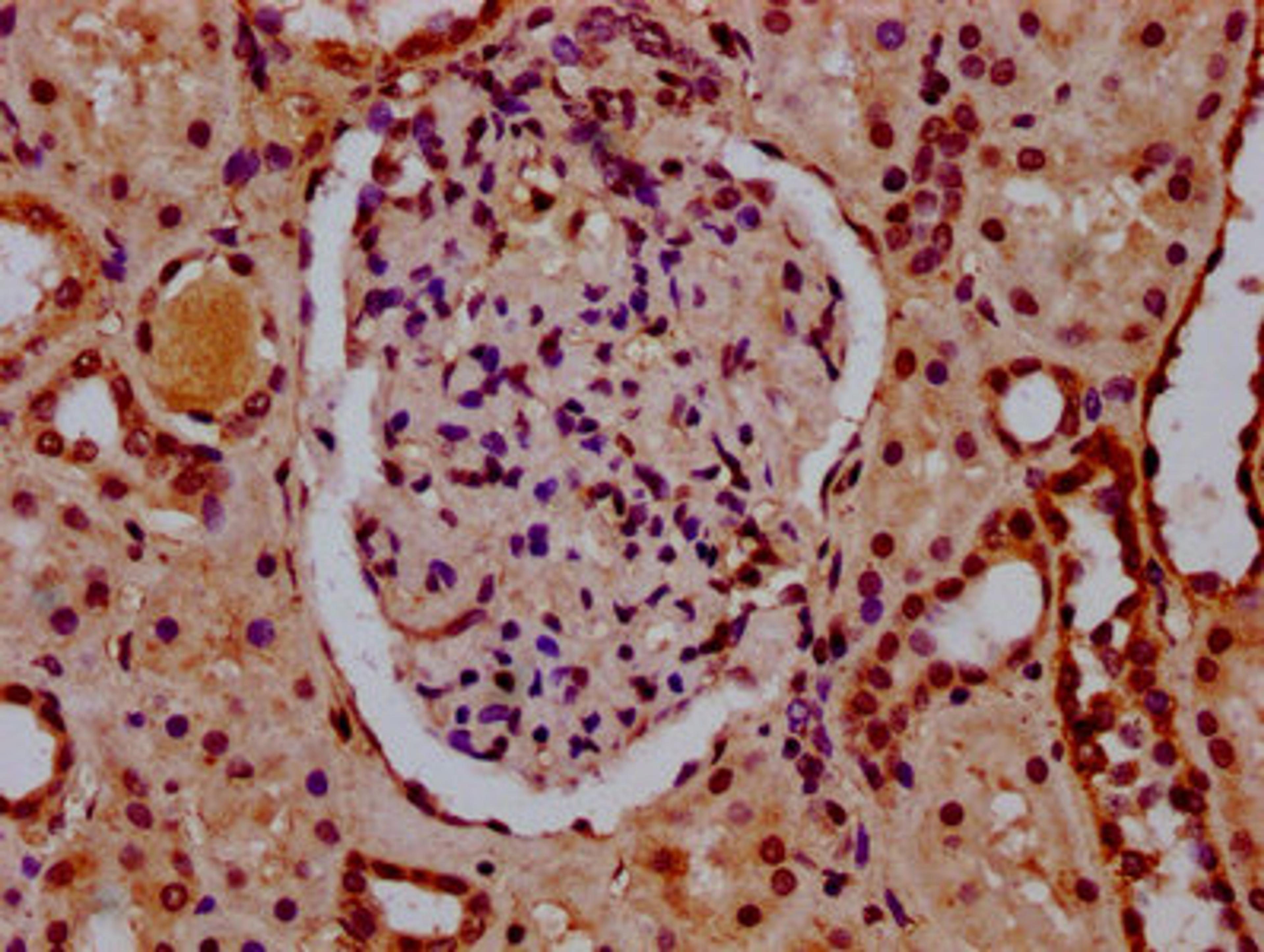 IHC image of CSB-PA010403OA34nsucHU diluted at 1:10 and staining in paraffin-embedded human kidney tissue performed on a Leica BondTM system. After dewaxing and hydration, antigen retrieval was mediated by high pressure in a citrate buffer (pH 6.0). Section was blocked with 10% normal goat serum 30min at RT. Then primary antibody (1% BSA) was incubated at 4&deg;C overnight. The primary is detected by a biotinylated secondary antibody and visualized using an HRP conjugated SP system.