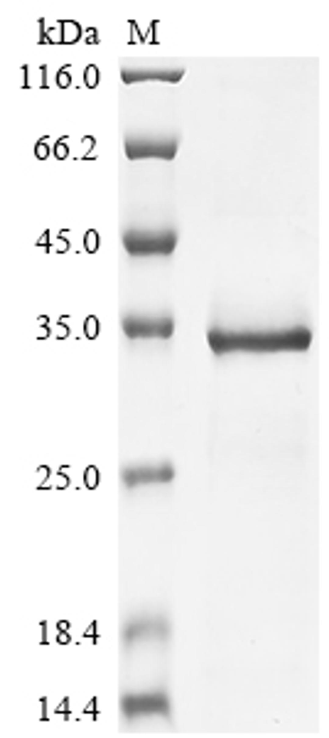 (Tris-Glycine gel) Discontinuous SDS-PAGE (reduced) with 5% enrichment gel and 15% separation gel.