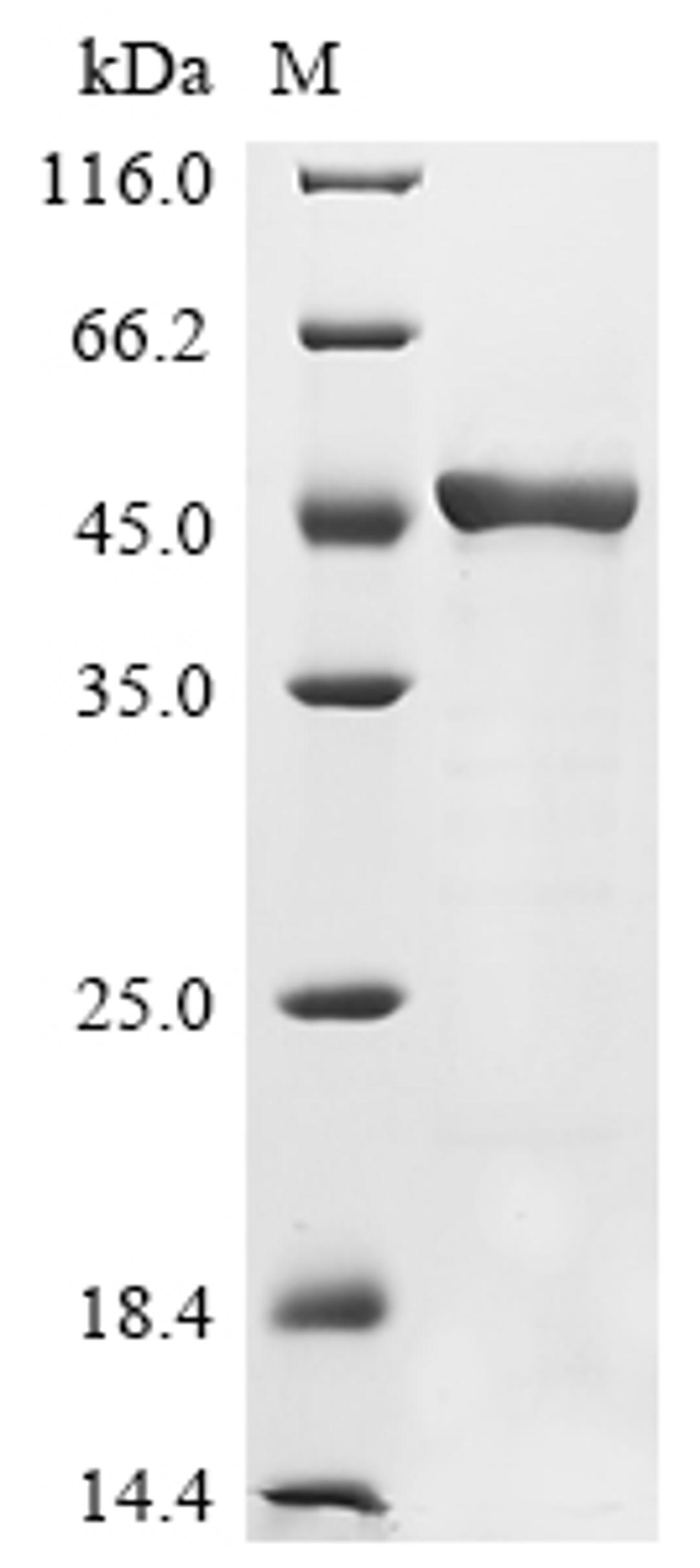 (Tris-Glycine gel) Discontinuous SDS-PAGE (reduced) with 5% enrichment gel and 15% separation gel.