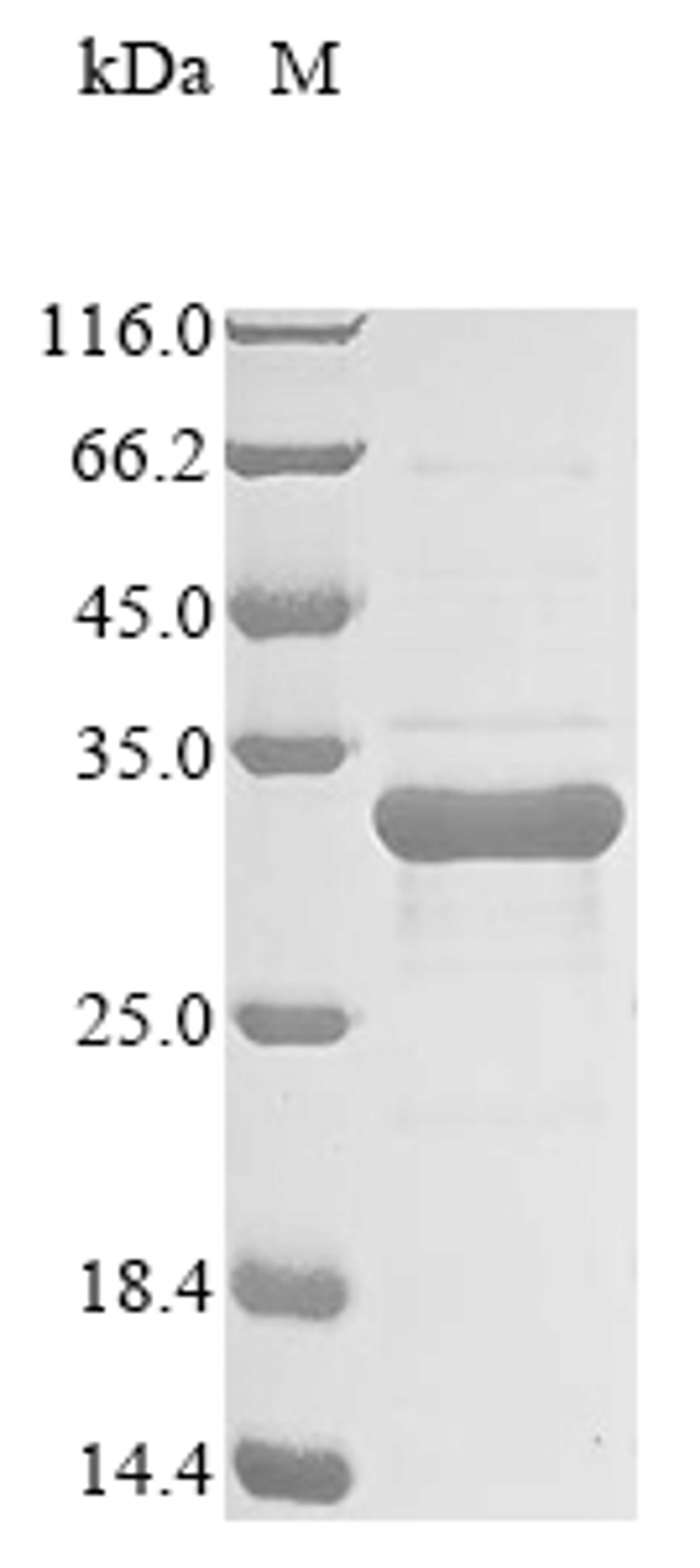 (Tris-Glycine gel) Discontinuous SDS-PAGE (reduced) with 5% enrichment gel and 15% separation gel.