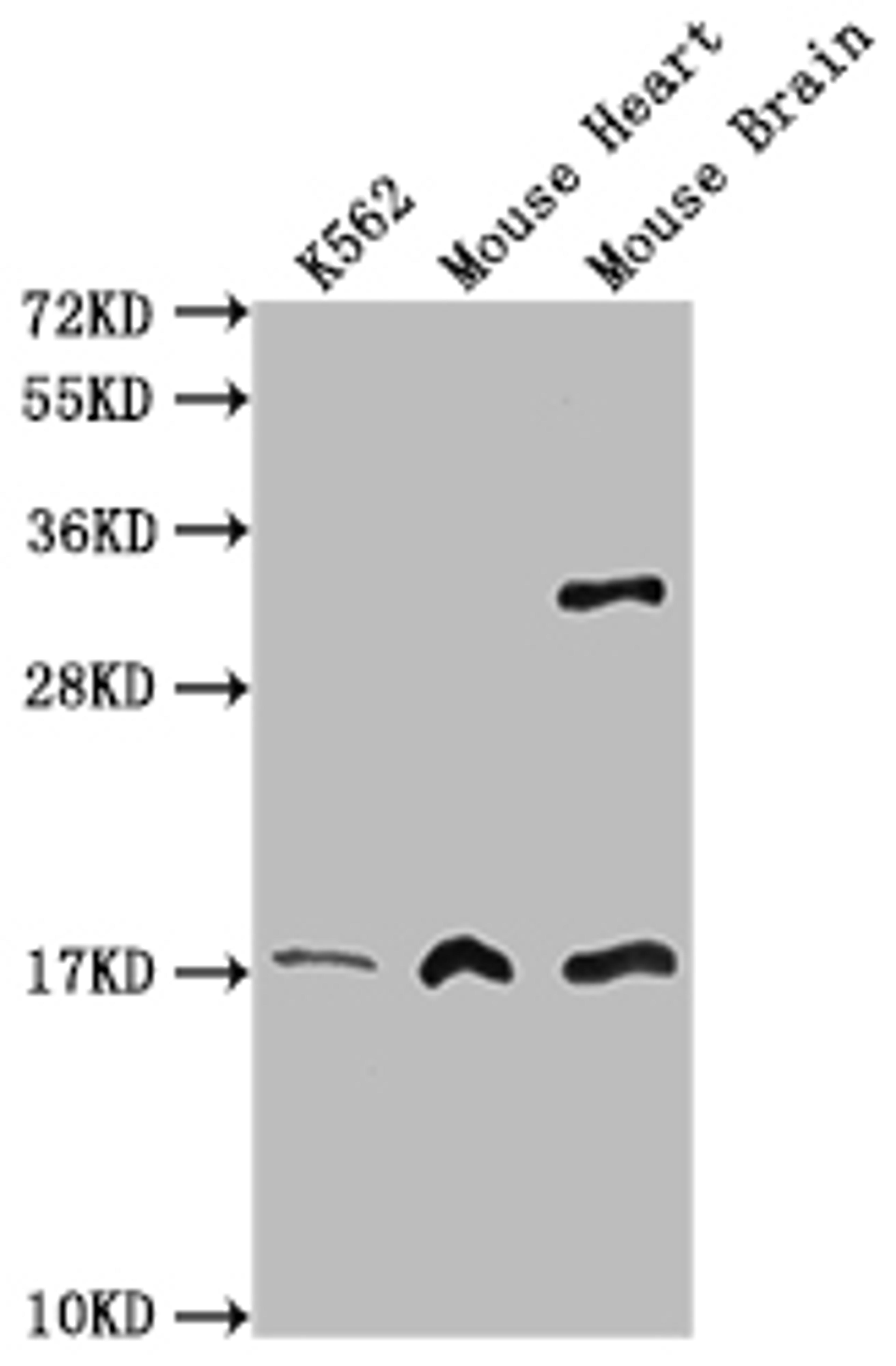 Western Blot. Positive WB detected in: K562 <span style="color: rgb(51, 51, 51); font-family: Arial, Helvetica;">whole cell lysate, </span>Mouse heart tissue, Mouse brain tissueAll lanes: FUNDC1 antibody at 3µg/ml. Secondary. Goat polyclonal to rabbit IgG at 1/50000 dilution. Predicted band size: 18 kDa. Observed band size: 18 kDa