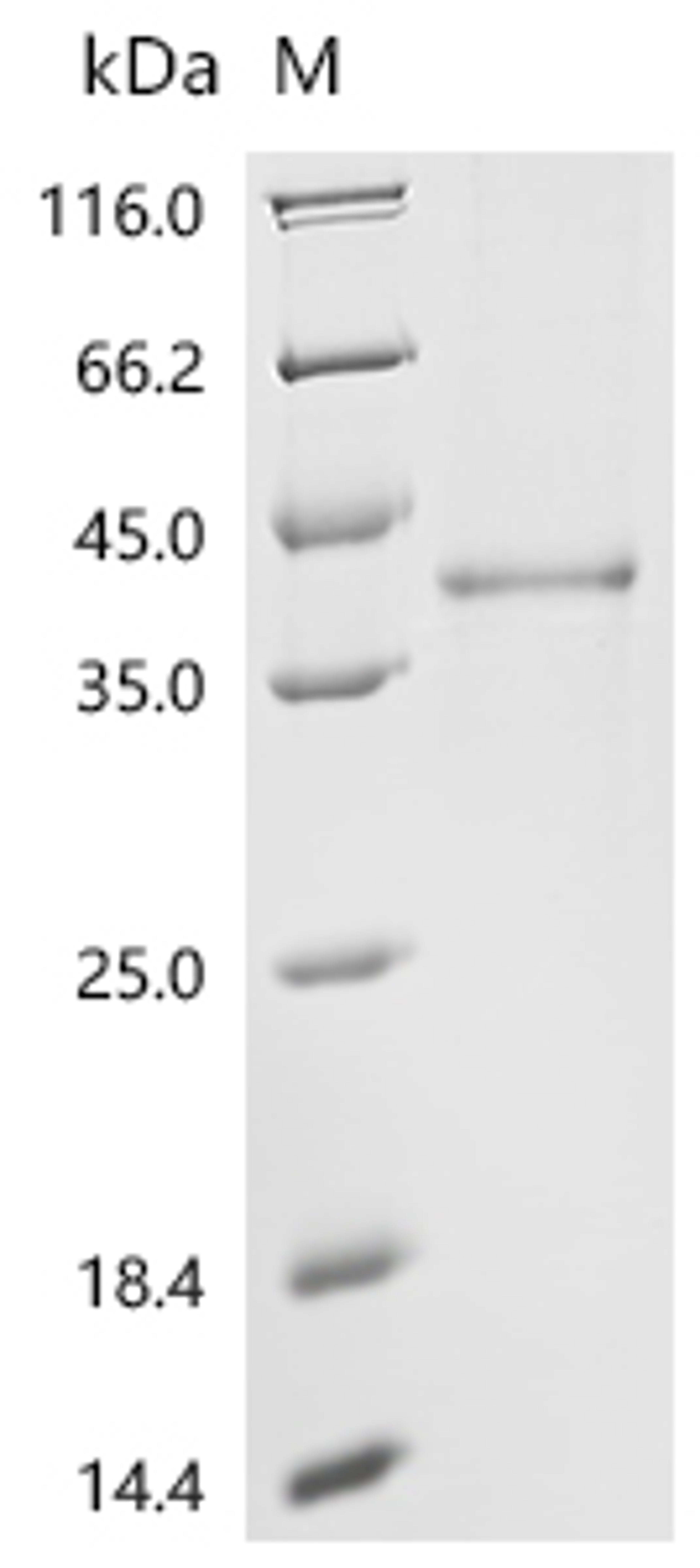 (Tris-Glycine gel) Discontinuous SDS-PAGE (reduced) with 5% enrichment gel and 15% separation gel.