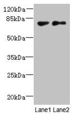 Western blot. All lanes: TTC30B antibody at 5µg/ml. Lane 1: MDA-MB-231 whole cell lysate. Lane 2: U251 whole cell lysate. Secondary. Goat polyclonal to rabbit IgG at 1/10000 dilution. Predicted band size: 77 kDa. Observed band size: 77 kDa