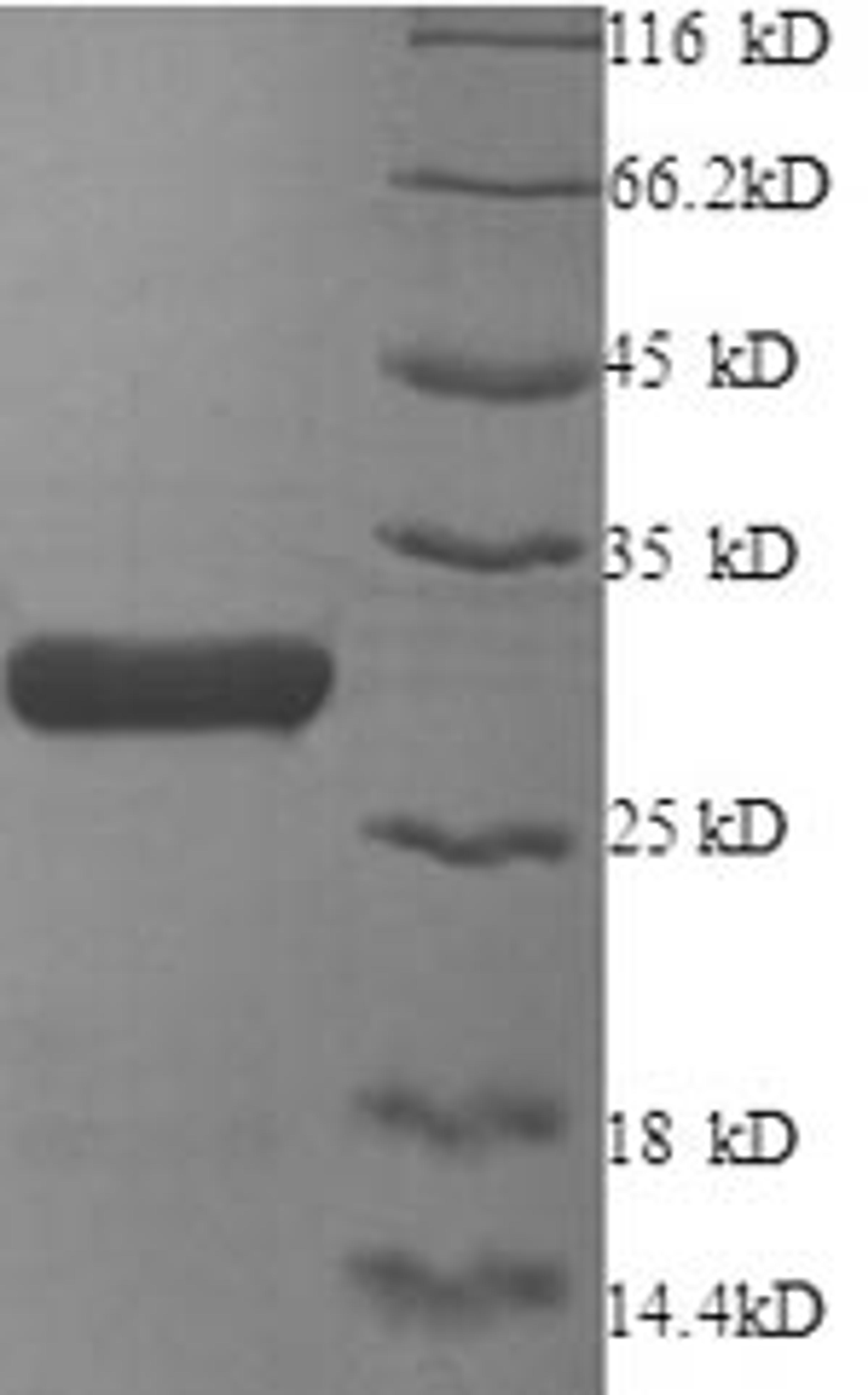 (Tris-Glycine gel) Discontinuous SDS-PAGE (reduced) with 5% enrichment gel and 15% separation gel.