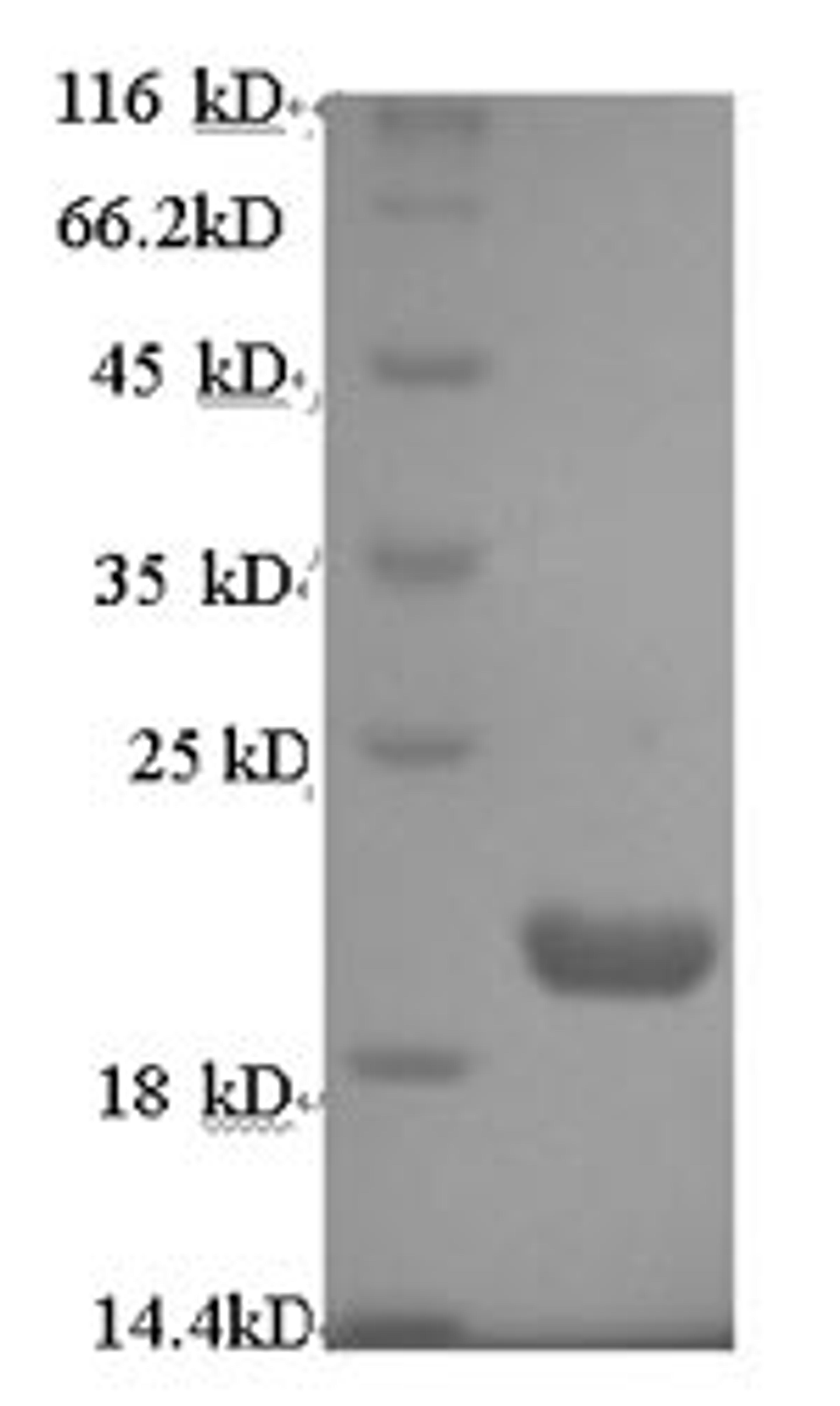 (Tris-Glycine gel) Discontinuous SDS-PAGE (reduced) with 5% enrichment gel and 15% separation gel.