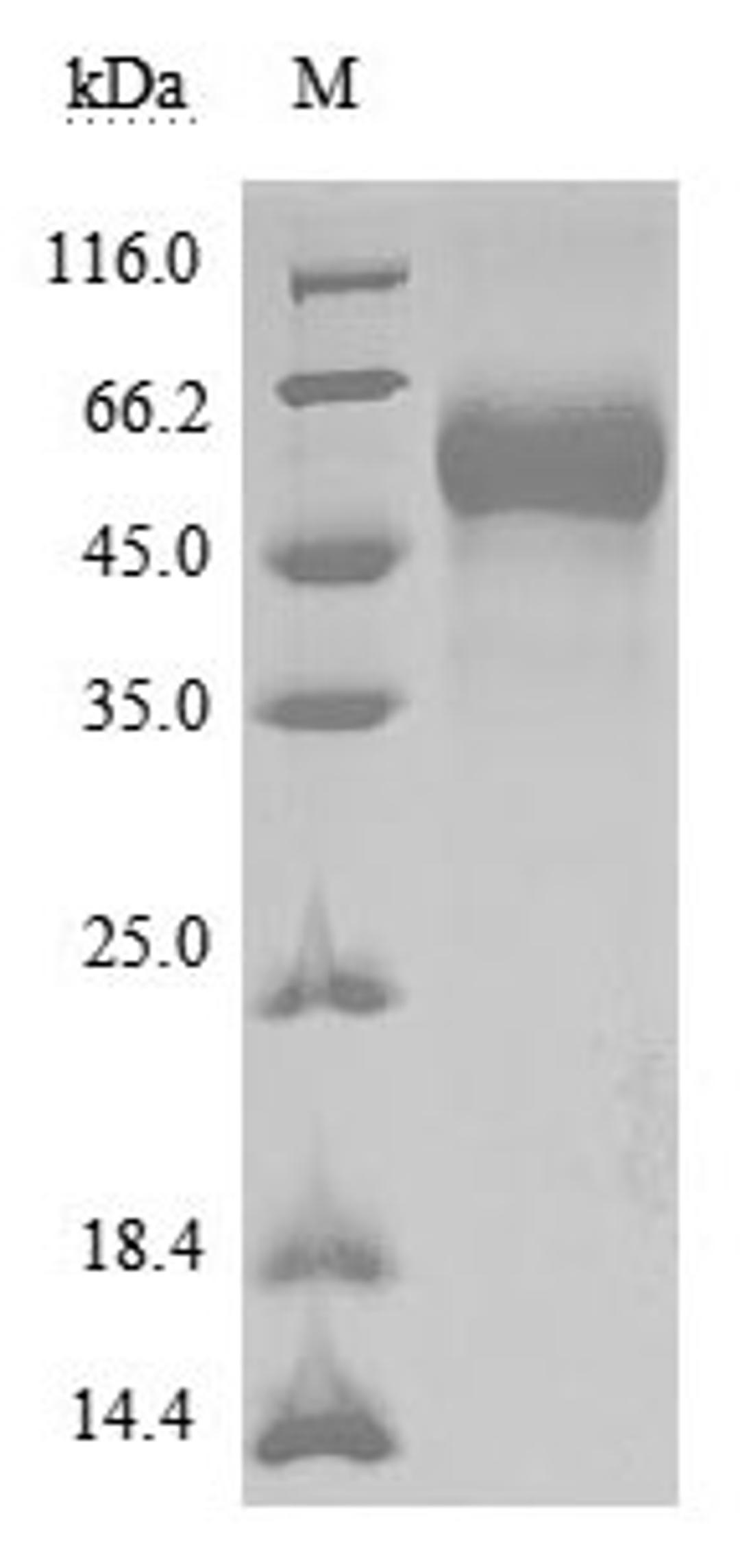 (Tris-Glycine gel) Discontinuous SDS-PAGE (reduced) with 5% enrichment gel and 15% separation gel.