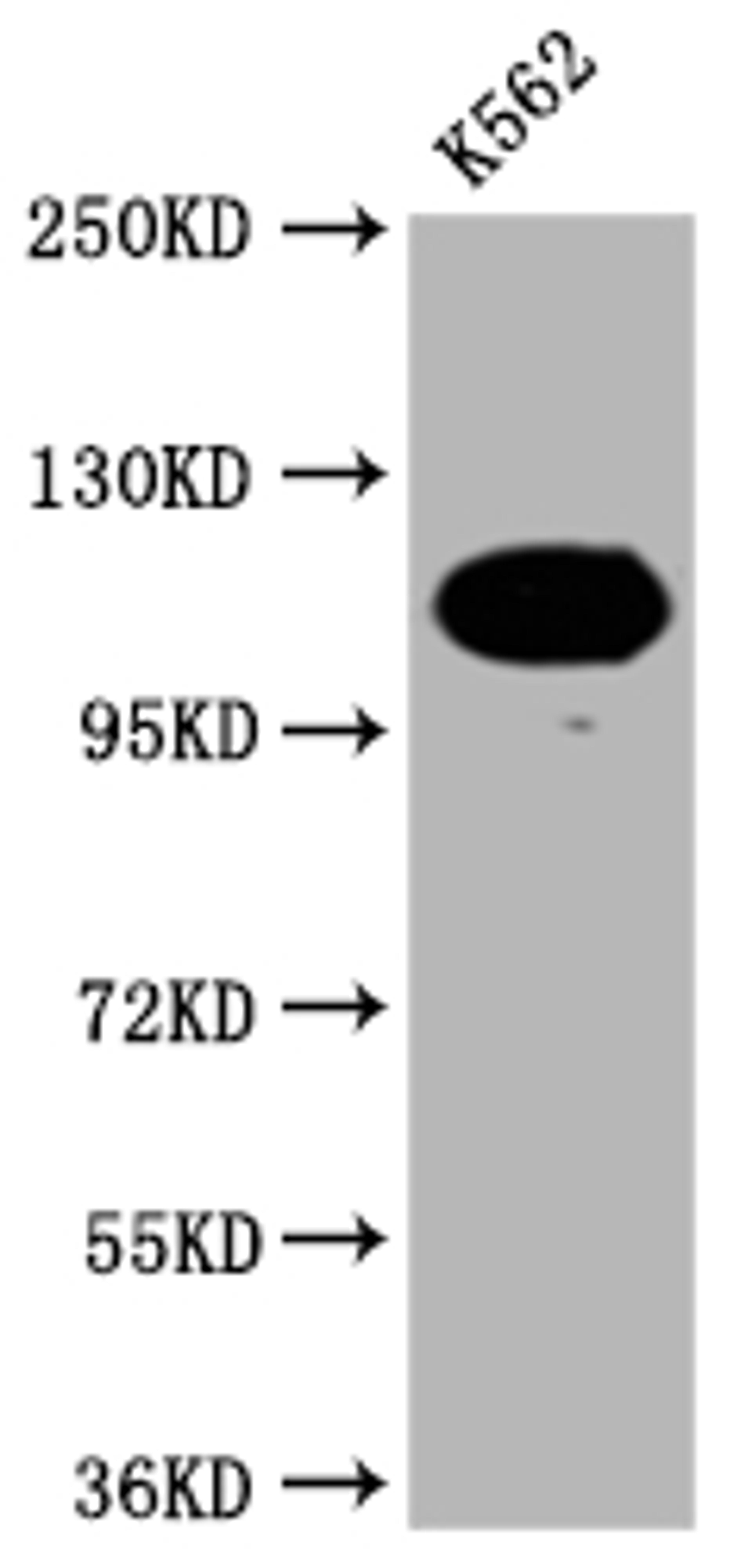 Western Blot. Positive WB detected in: K562 whole cell lysate. All lanes: PARP antibody at 1:2000. Secondary. Goat polyclonal to rabbit IgG at 1/50000 dilution. Predicted band size: 114 KDa. Observed band size: 114 kDa. 