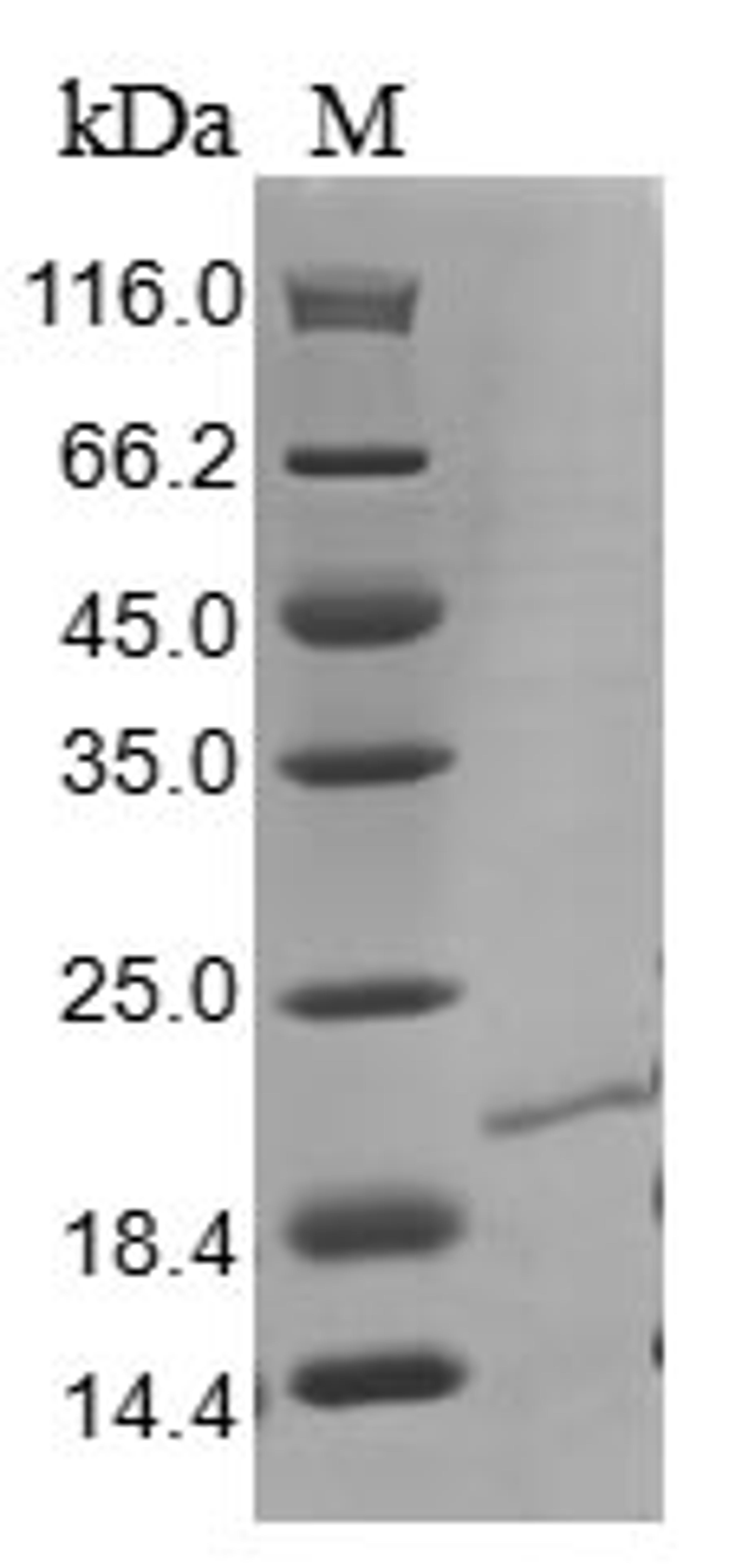 (Tris-Glycine gel) Discontinuous SDS-PAGE (reduced) with 5% enrichment gel and 15% separation gel.