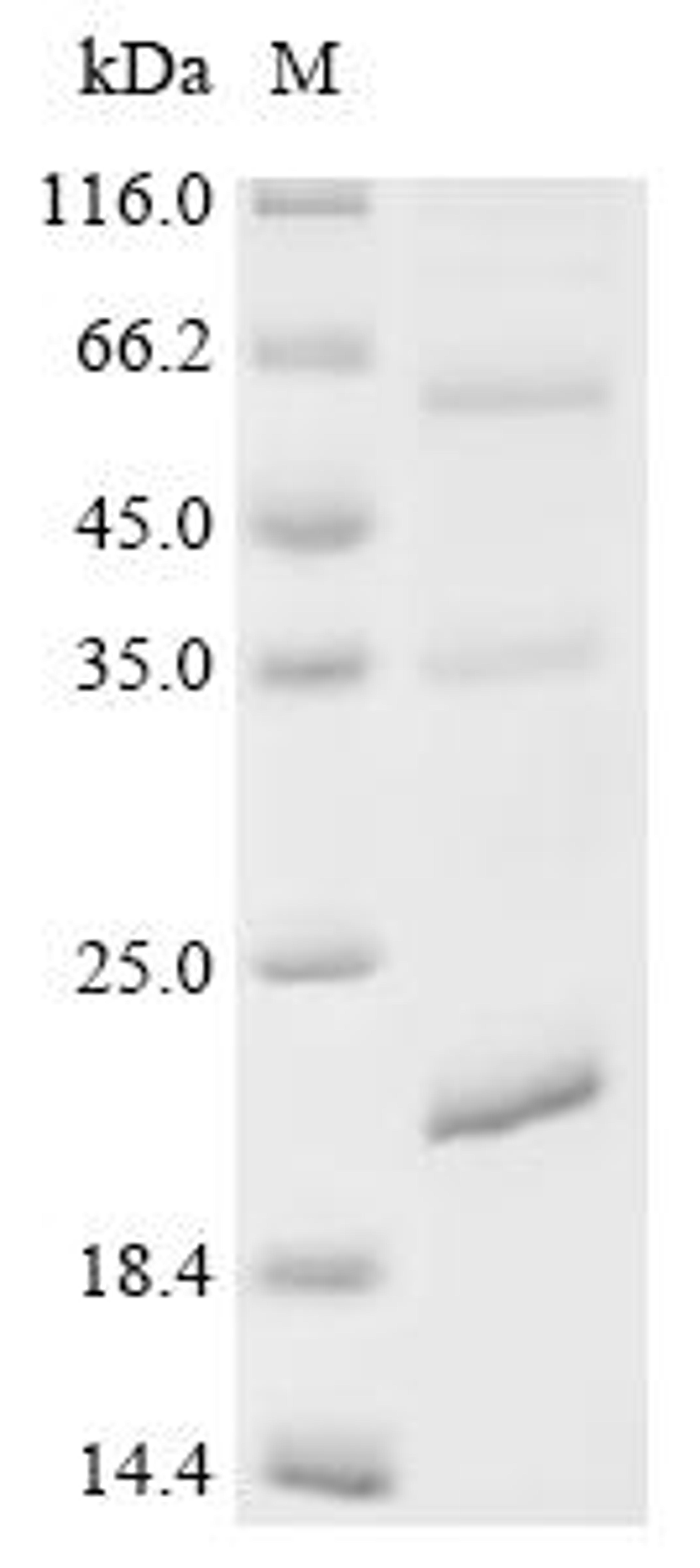 (Tris-Glycine gel) Discontinuous SDS-PAGE (reduced) with 5% enrichment gel and 15% separation gel.