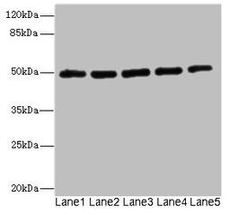 Western blot. All lanes: KCNJ4 antibody at 2.04µg/ml. Lane 1: Hela whole cell lysate. Lane 2: 293T whole cell lysate. Lane 3: HepG2 whole cell lysate. Lane 4: Jurkat whole cell lysate. Lane 5: MCF-7 whole cell lysate. Secondary. Goat polyclonal to rabbit IgG at 1/10000 dilution. Predicted band size: 50 kDa. Observed band size: 50 kDa
