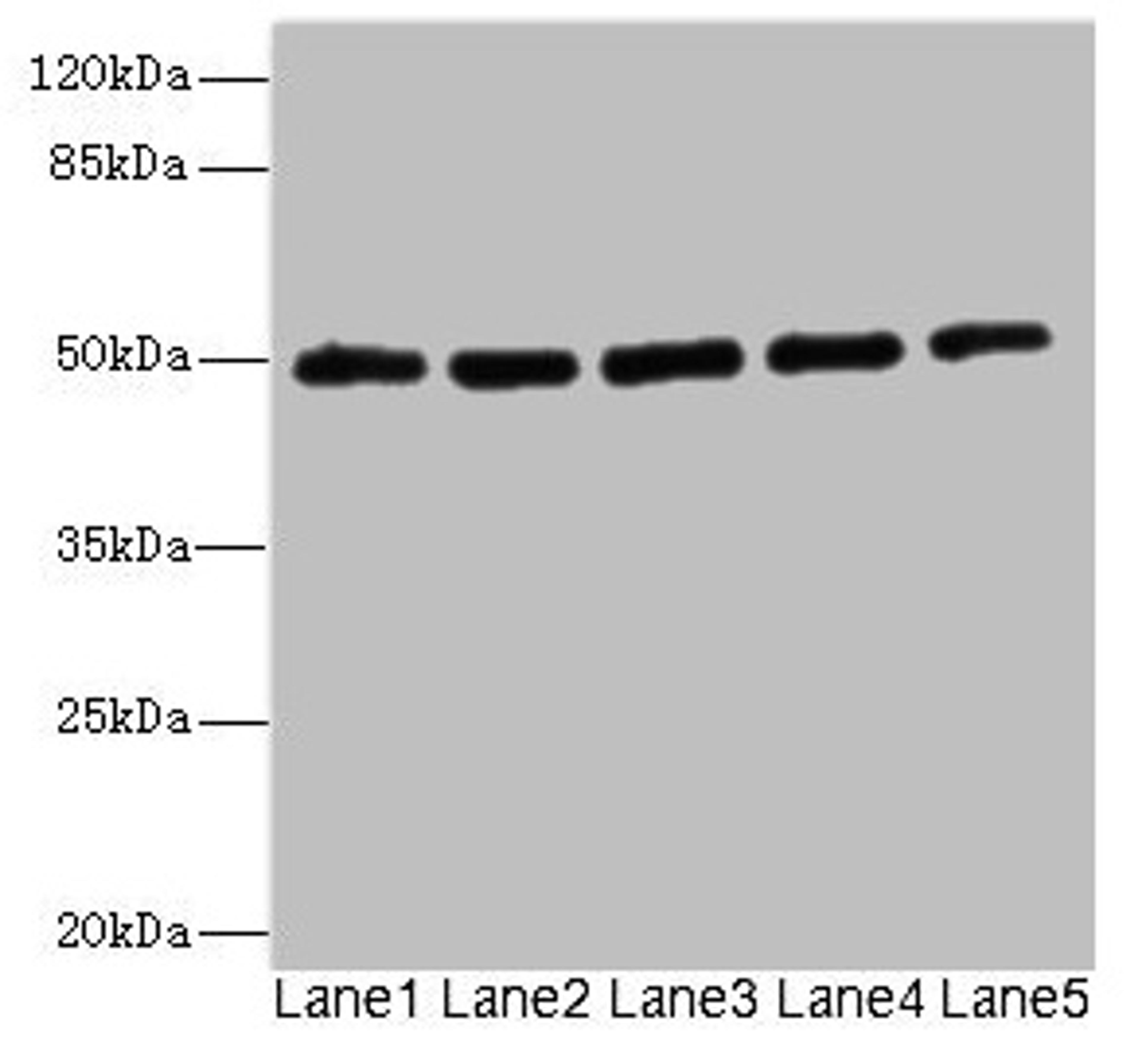 Western blot. All lanes: KCNJ4 antibody at 2.04µg/ml. Lane 1: Hela whole cell lysate. Lane 2: 293T whole cell lysate. Lane 3: HepG2 whole cell lysate. Lane 4: Jurkat whole cell lysate. Lane 5: MCF-7 whole cell lysate. Secondary. Goat polyclonal to rabbit IgG at 1/10000 dilution. Predicted band size: 50 kDa. Observed band size: 50 kDa