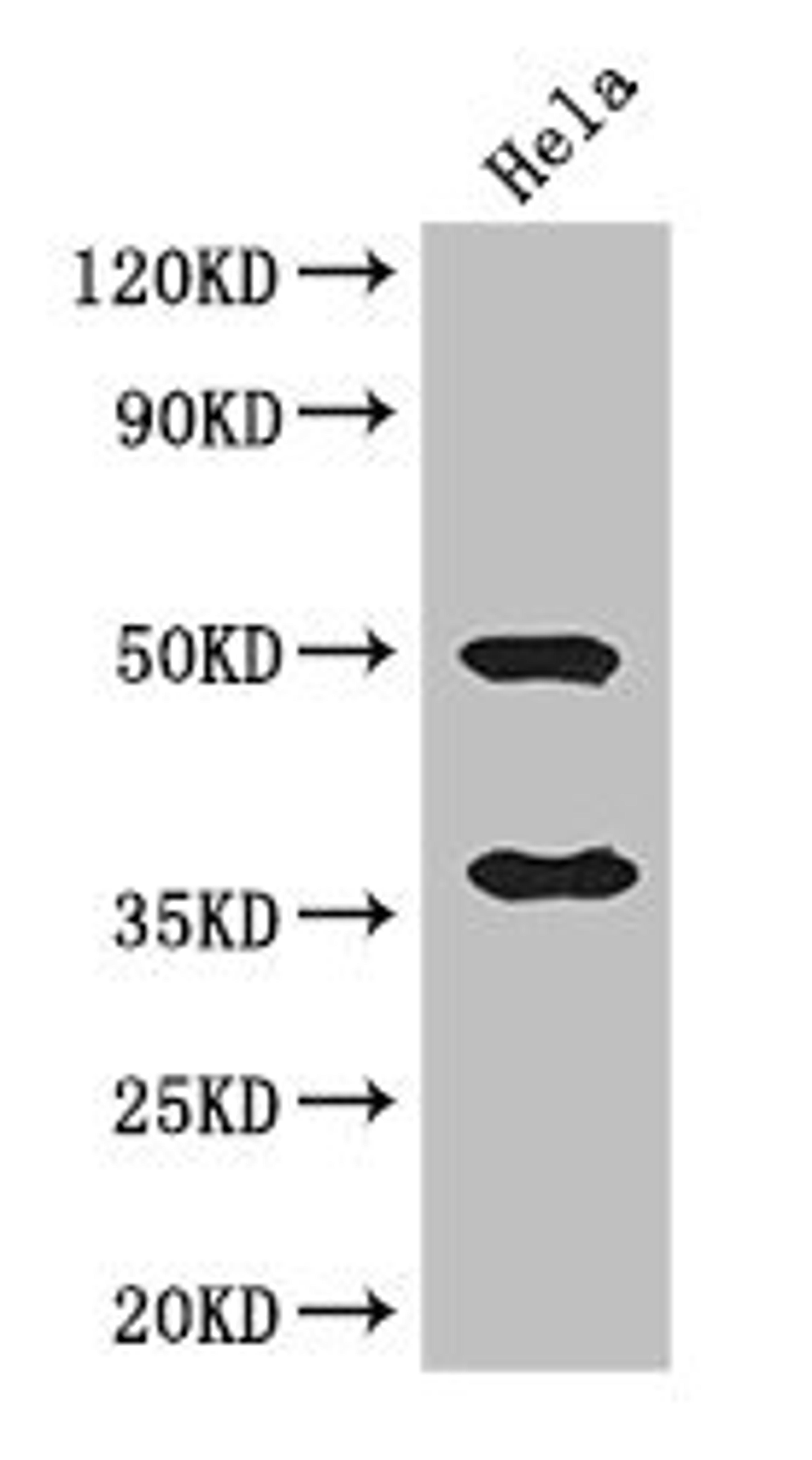 Western Blot. Positive WB detected in: Hela whole cell lysate. All lanes: AKR1B1 antibody at 3ug/ml. Secondary. Goat polyclonal to rabbit IgG at 1/50000 dilution. Predicted band size: 36 kDa. Observed band size: 36, 50 kDa.