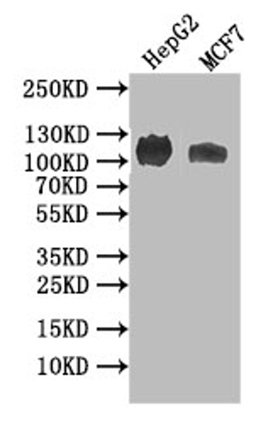 Western Blot. Positive WB detected in: HEPG2 whole cell lysate, MCF7 whole cell lysate. All lanes: ANPRB antibody at 1:1000. Secondary. Goat polyclonal to rabbit IgG at 1/50000 dilution. Predicted band size: 117 kDa. Observed band size: 117 kDa. 