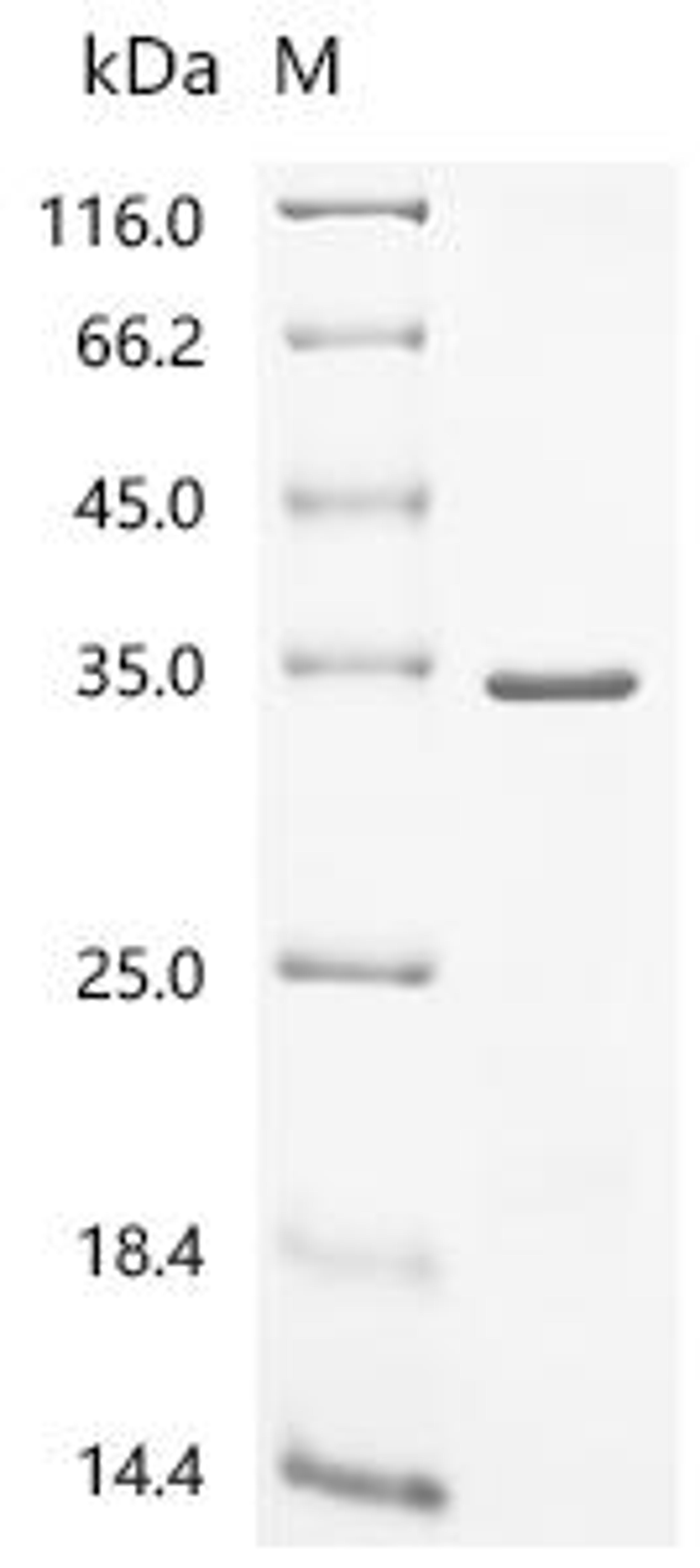 (Tris-Glycine gel) Discontinuous SDS-PAGE (reduced) with 5% enrichment gel and 15% separation gel.