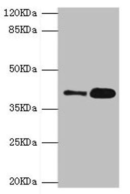 Western blot. All lanes: GDAP1 antibody at 4.15µg/ml. Lane 1: MCF-7 whole cell lysate. Lane 2: Mouse brain tissue. Secondary. Goat polyclonal to rabbit IgG at 1/10000 dilution. Predicted band size: 42, 34 kDa. Observed band size: 42 kDa
