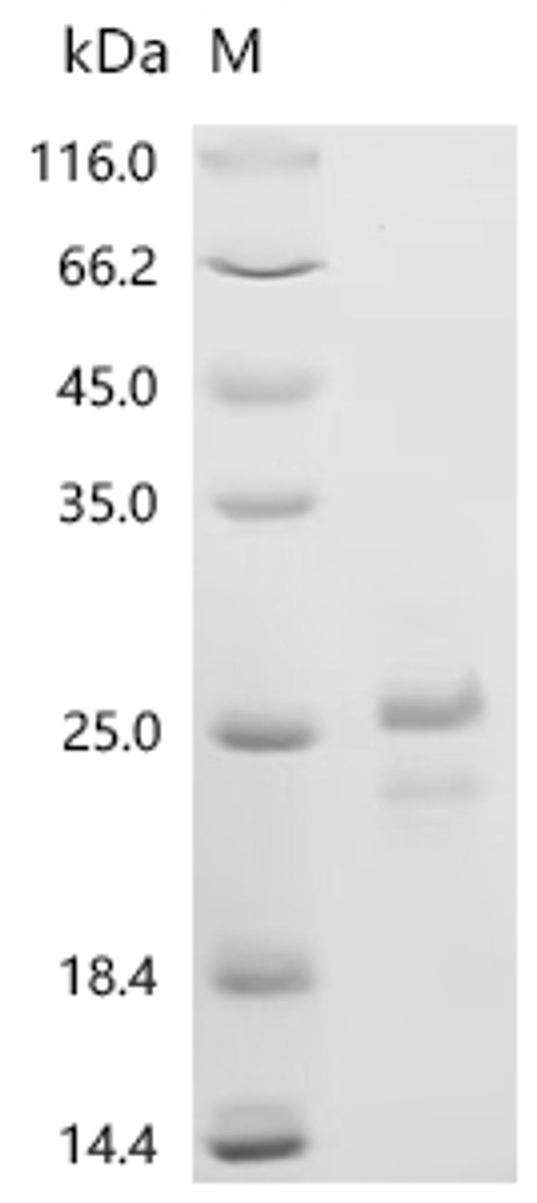 (Tris-Glycine gel) Discontinuous SDS-PAGE (reduced) with 5% enrichment gel and 15% separation gel.