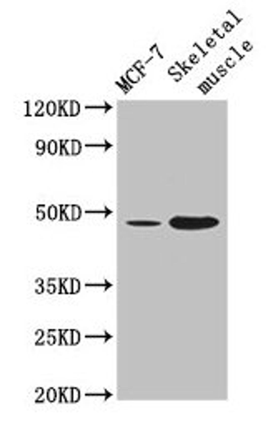 Western Blot. Positive WB detected in: MCF-7 whole cell lysate, Mouse skeletal muscle tissue. All lanes: ARRDC3 antibody at 4µg/ml. Secondary. Goat polyclonal to rabbit IgG at 1/50000 dilution. Predicted band size: 47 kDa. Observed band size: 47 kDa