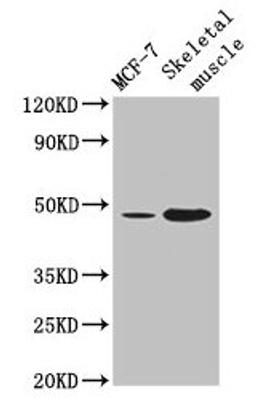 Western Blot. Positive WB detected in: MCF-7 whole cell lysate, Mouse skeletal muscle tissue. All lanes: ARRDC3 antibody at 4µg/ml. Secondary. Goat polyclonal to rabbit IgG at 1/50000 dilution. Predicted band size: 47 kDa. Observed band size: 47 kDa
