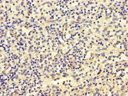 Immunohistochemistry of paraffin-embedded human spleen tissue using CSB-PA773047LA01HU at dilution of 1:100