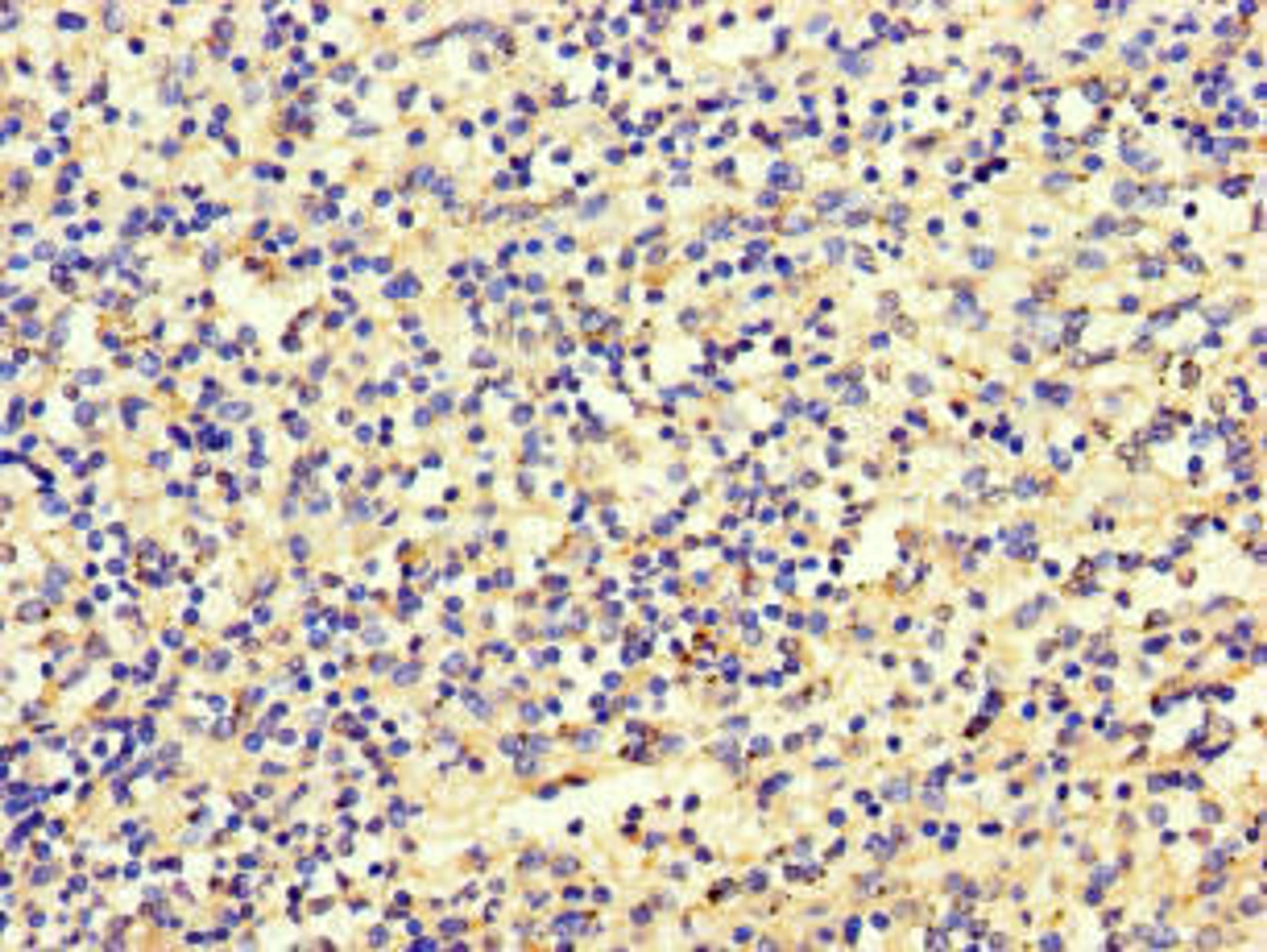 Immunohistochemistry of paraffin-embedded human spleen tissue using CSB-PA773047LA01HU at dilution of 1:100