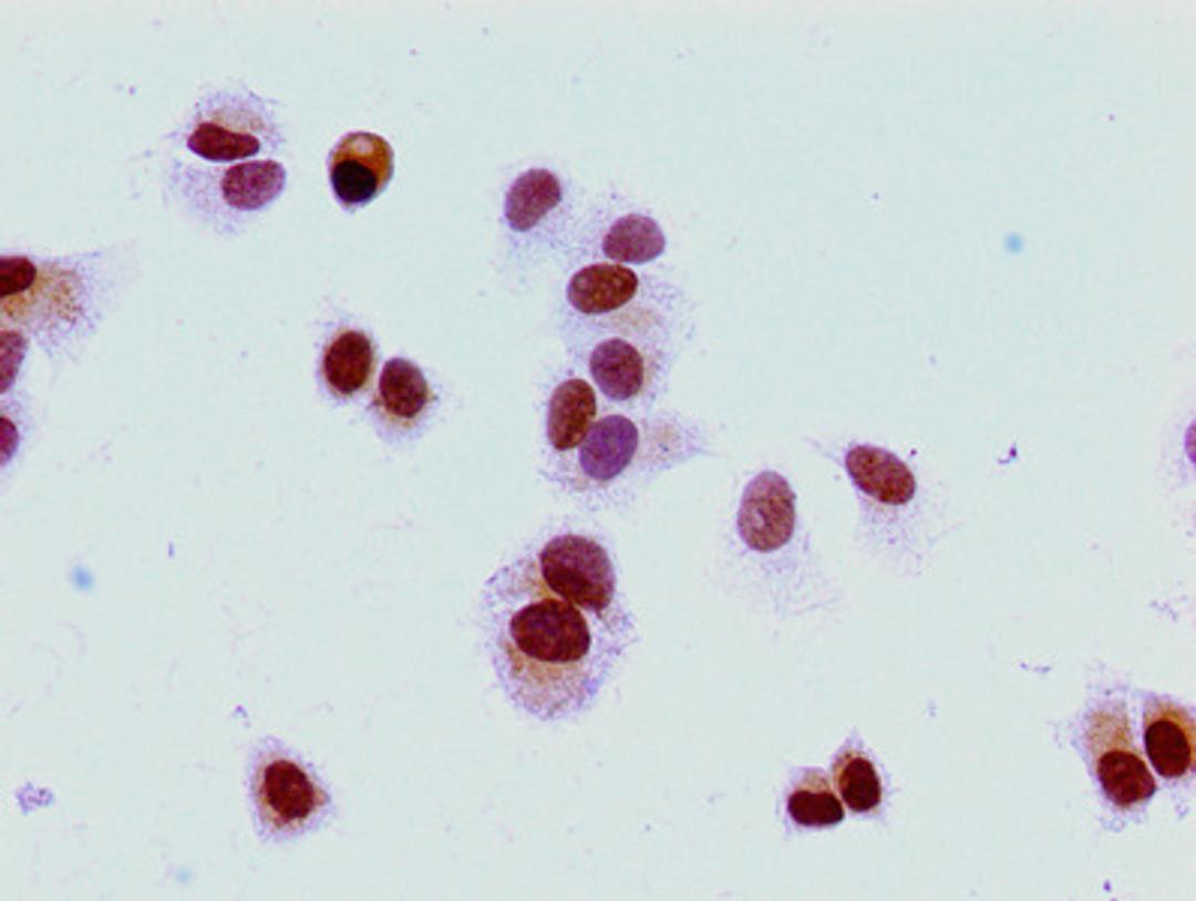 Immunocytochemistry analysis of MCF-7 cells using CSB-PA010380PA16me2HU at dilution of 1:100