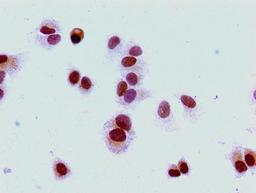 Immunocytochemistry analysis of MCF-7 cells using CSB-PA010380PA16me2HU at dilution of 1:100