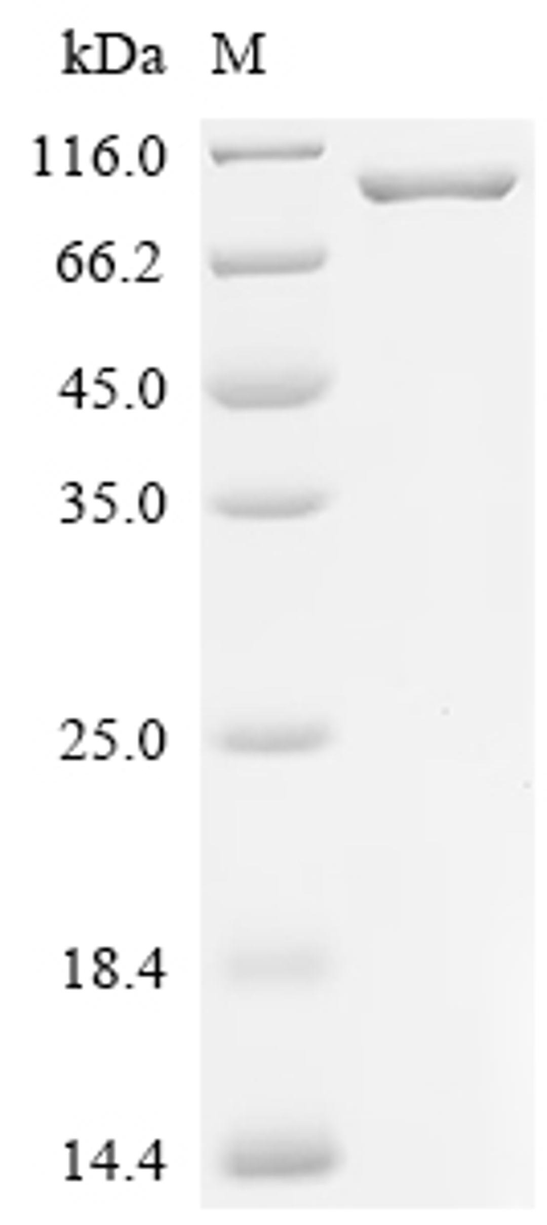 (Tris-Glycine gel) Discontinuous SDS-PAGE (reduced) with 5% enrichment gel and 15% separation gel.