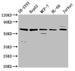 Western Blot. Positive WB detected in: SH-SY5Y whole cell lysate, HepG2 whole cell lysate, MCF-7 whole cell lysate, HL-60 whole cell lysate, Jurkat whole cell lysate. All lanes: HRG antibody at 4.6µg/ml. Secondary. Goat polyclonal to rabbit IgG at 1/50000 dilution. Predicted band size: 60 kDa. Observed band size: 60 kDa