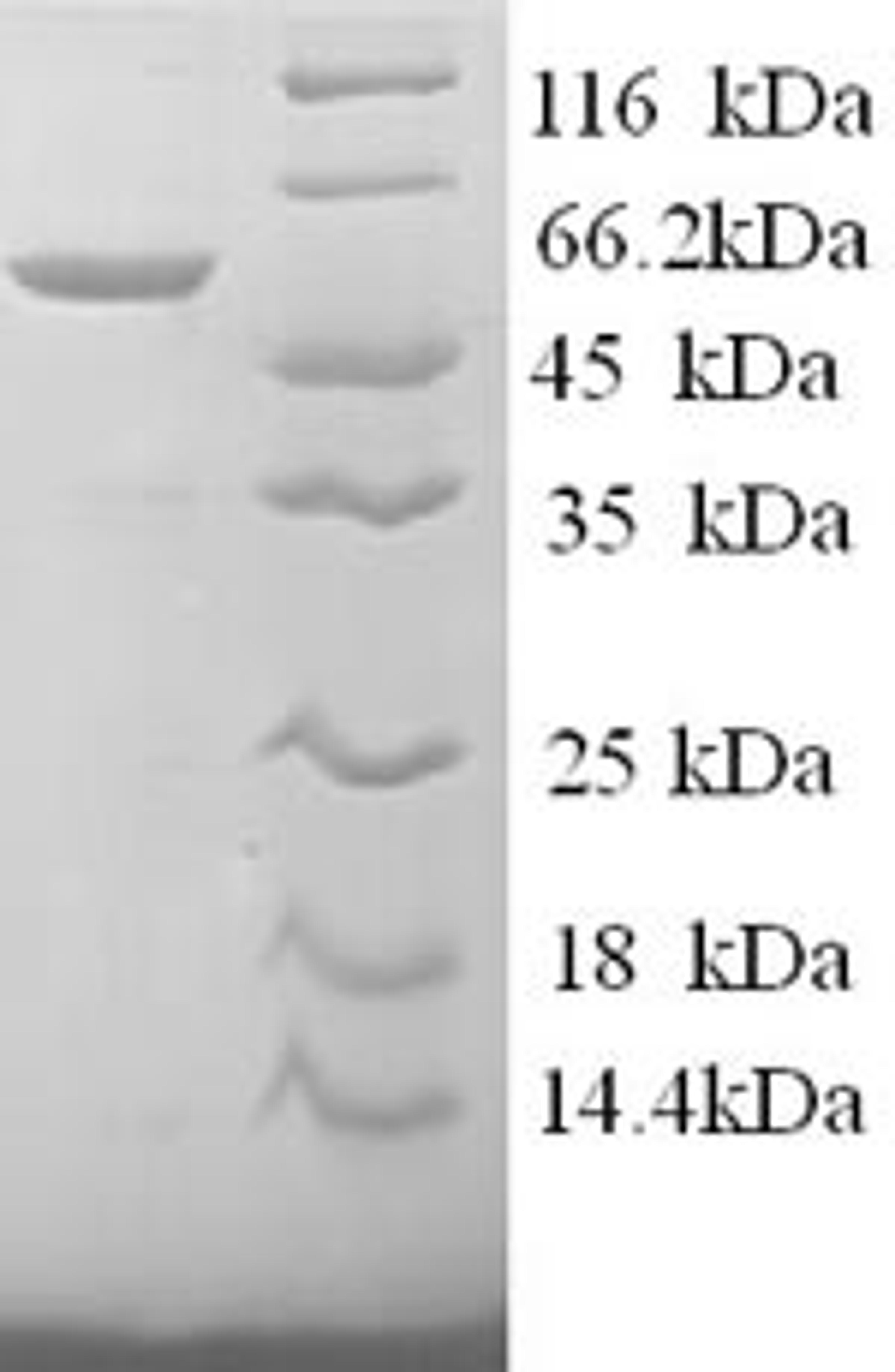 (Tris-Glycine gel) Discontinuous SDS-PAGE (reduced) with 5% enrichment gel and 15% separation gel.