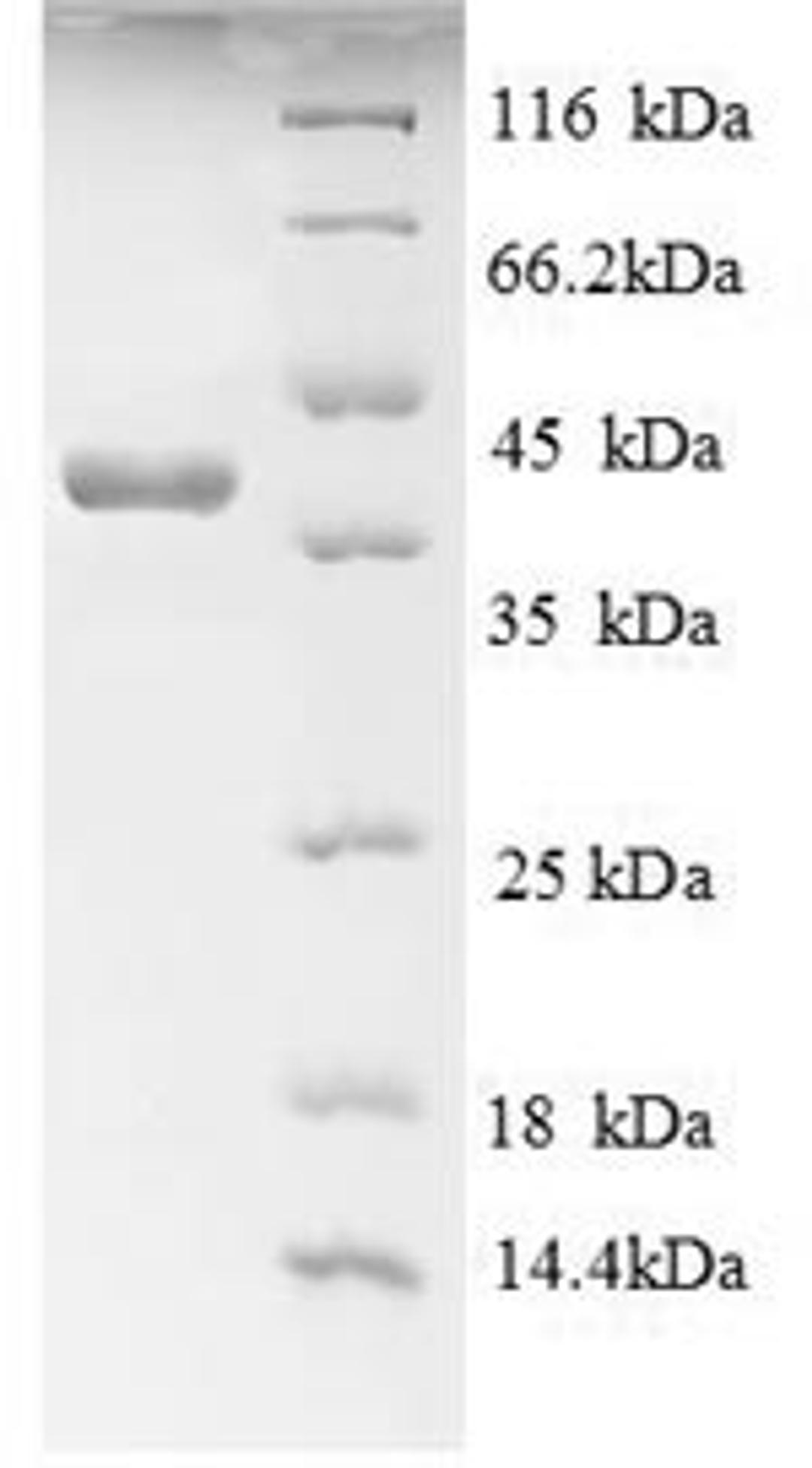 (Tris-Glycine gel) Discontinuous SDS-PAGE (reduced) with 5% enrichment gel and 15% separation gel.