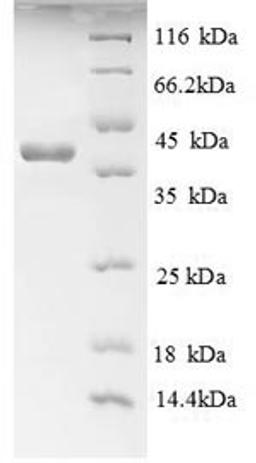 (Tris-Glycine gel) Discontinuous SDS-PAGE (reduced) with 5% enrichment gel and 15% separation gel.