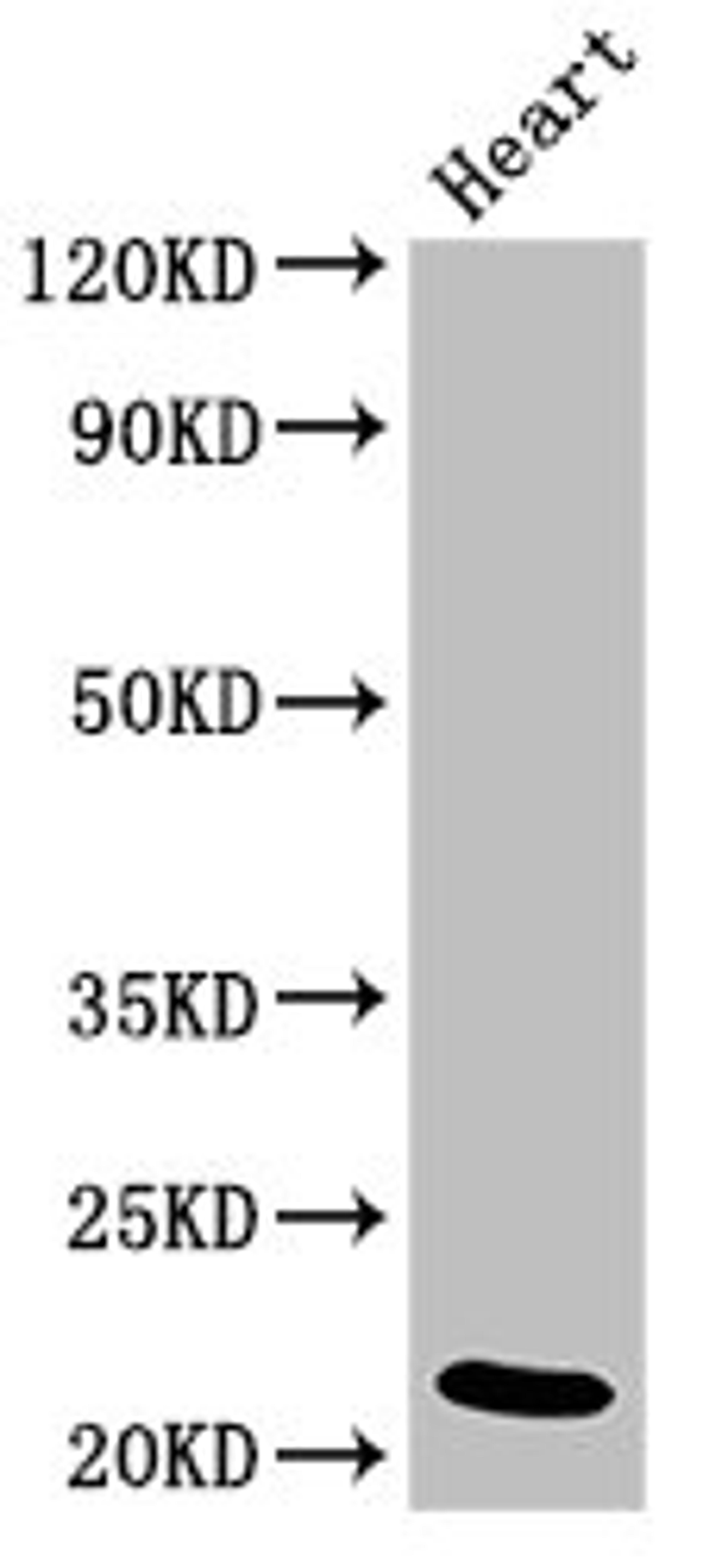 Western Blot. Positive WB detected in: Rat heart tissue. All lanes: NDUFB9 antibody at 4ug/ml. Secondary. Goat polyclonal to rabbit IgG at 1/50000 dilution. Predicted band size: 22 kDa. Observed band size: 22 kDa. 